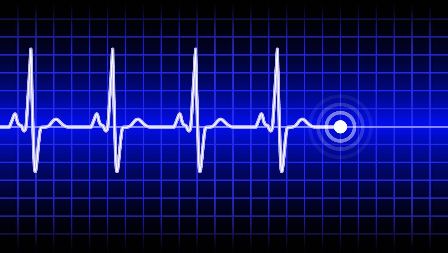 Abbott’s three big heart deals have one thing in common