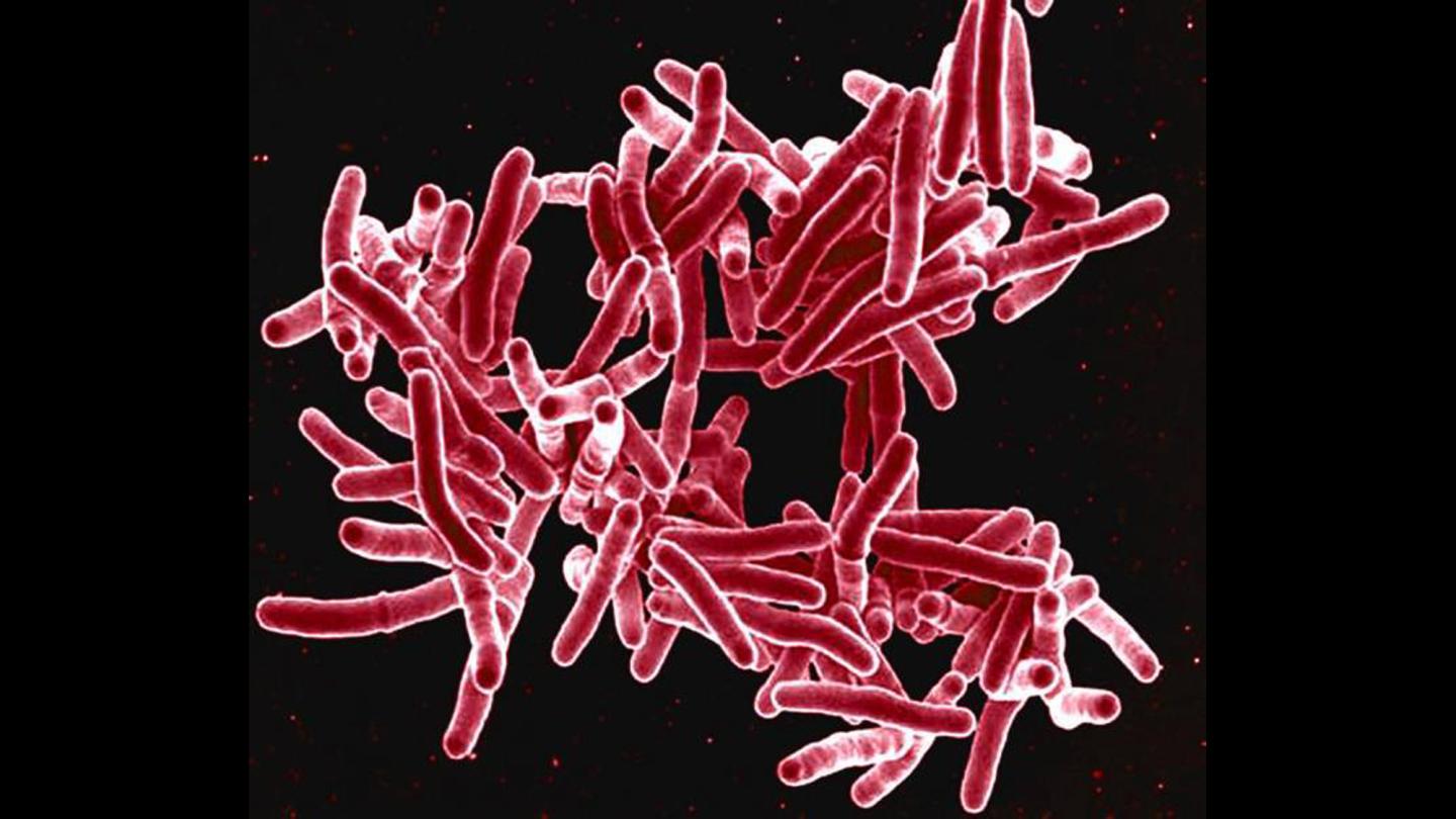 Drug-resistant infections could cost the global economy $100 trillion by 2050