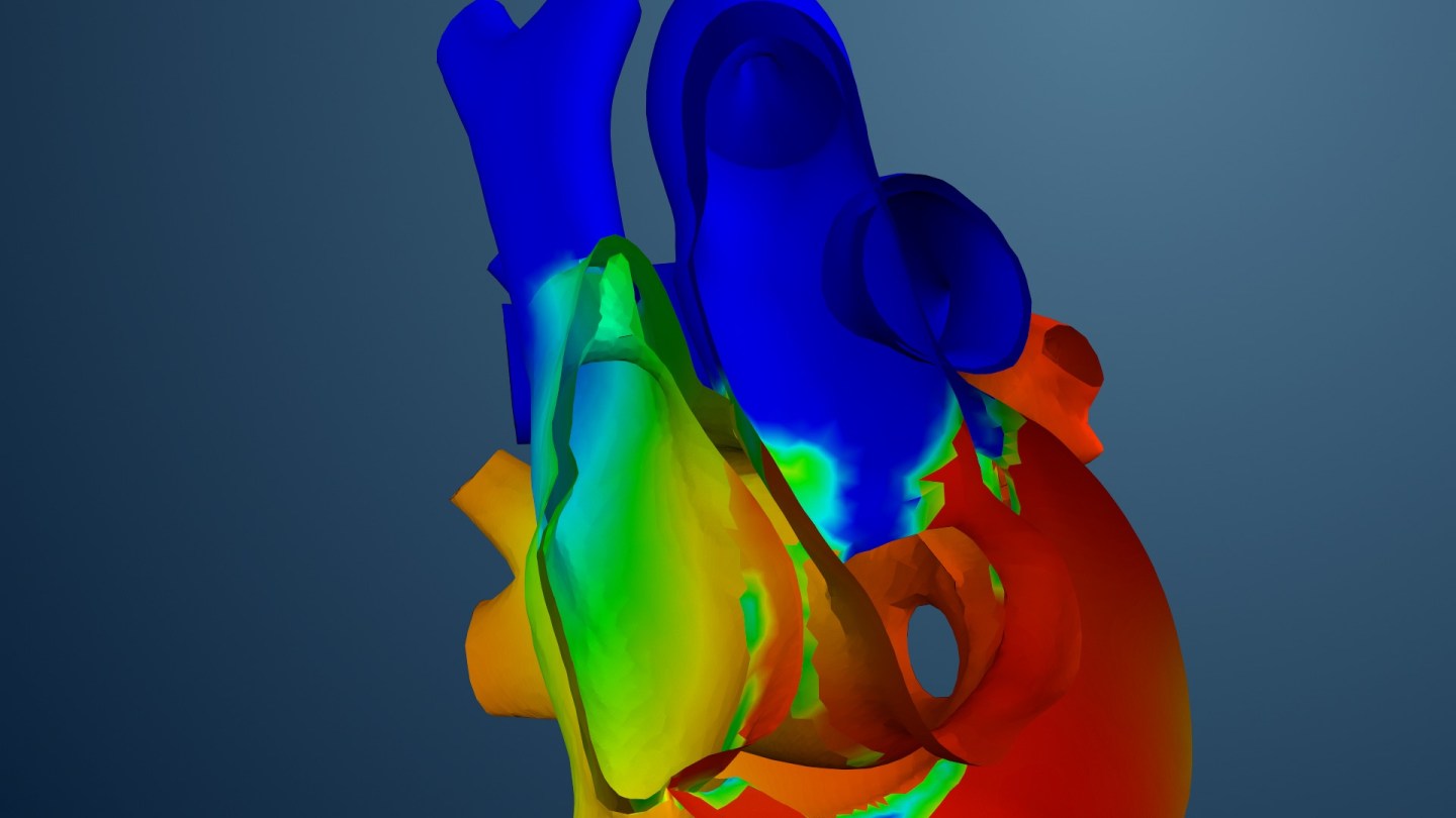 The Living Heart Project Dassault Systemes