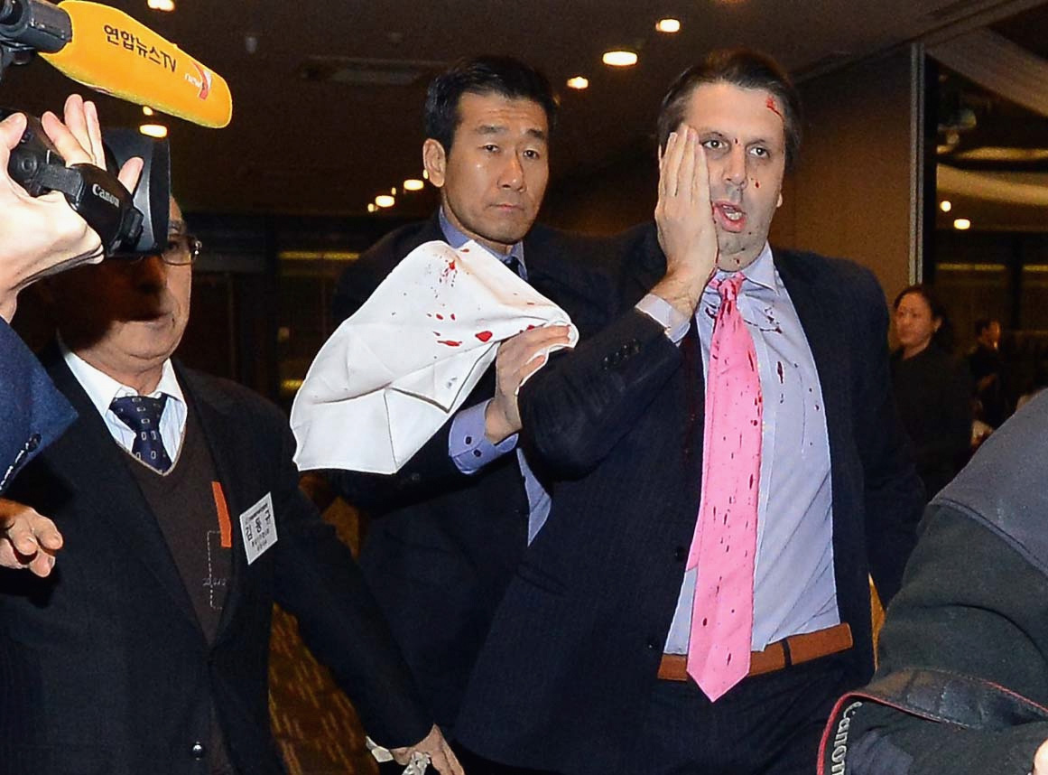 U.S. Ambassador to South Korea Mark Lippert Injured In Attack
