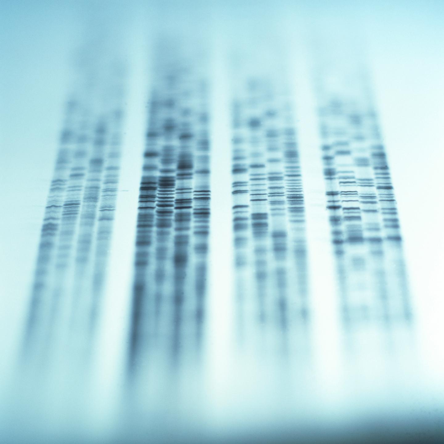 Autoradiogram showing a DNA fingerprint