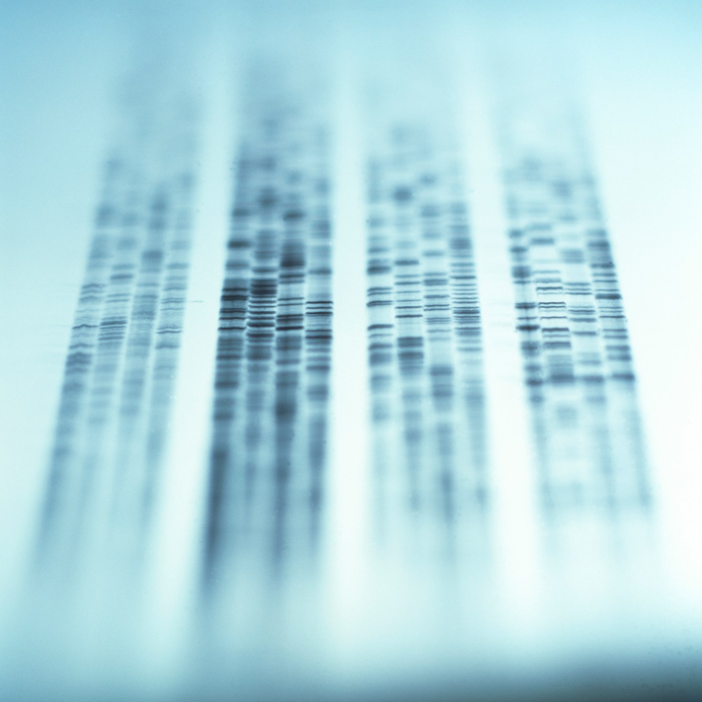 Autoradiogram showing a DNA fingerprint