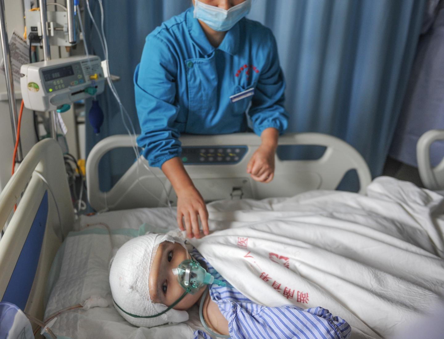 3-year-old Girl Changes A 3D Printed Skull In Changsha