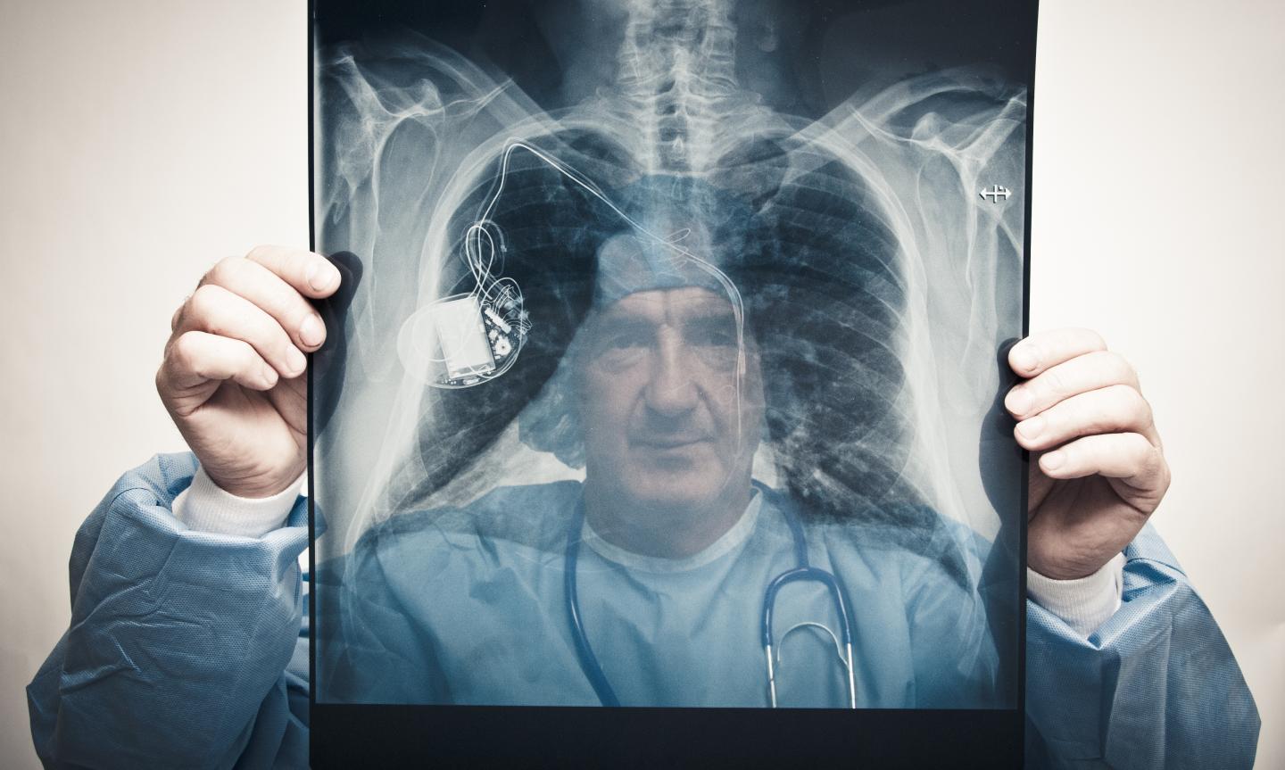 Doctor examining pacemaker on chest x-ray