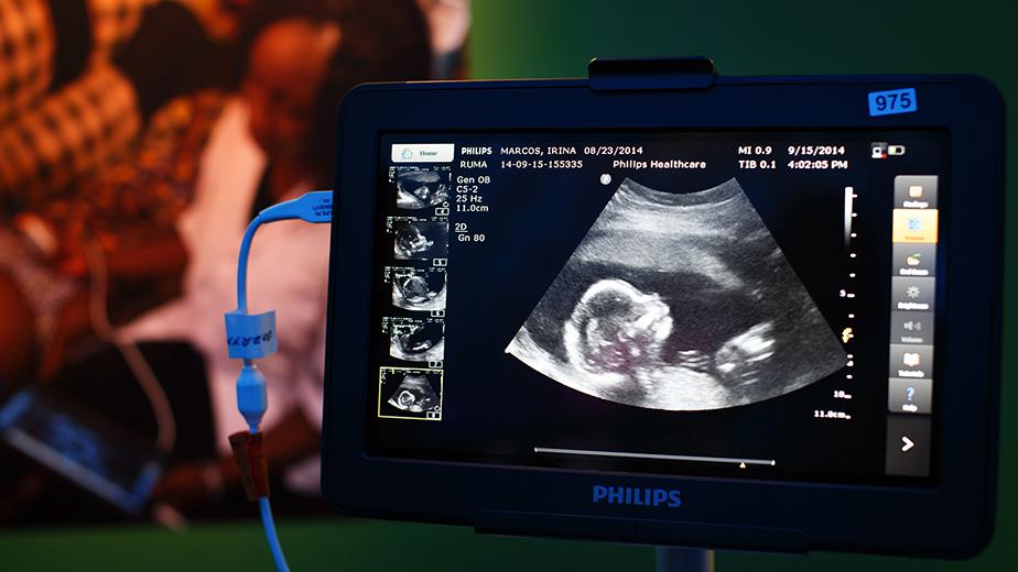 Royal Philips NV Chief Executive Officer Frans Van Houten Speaks At Innovation Day