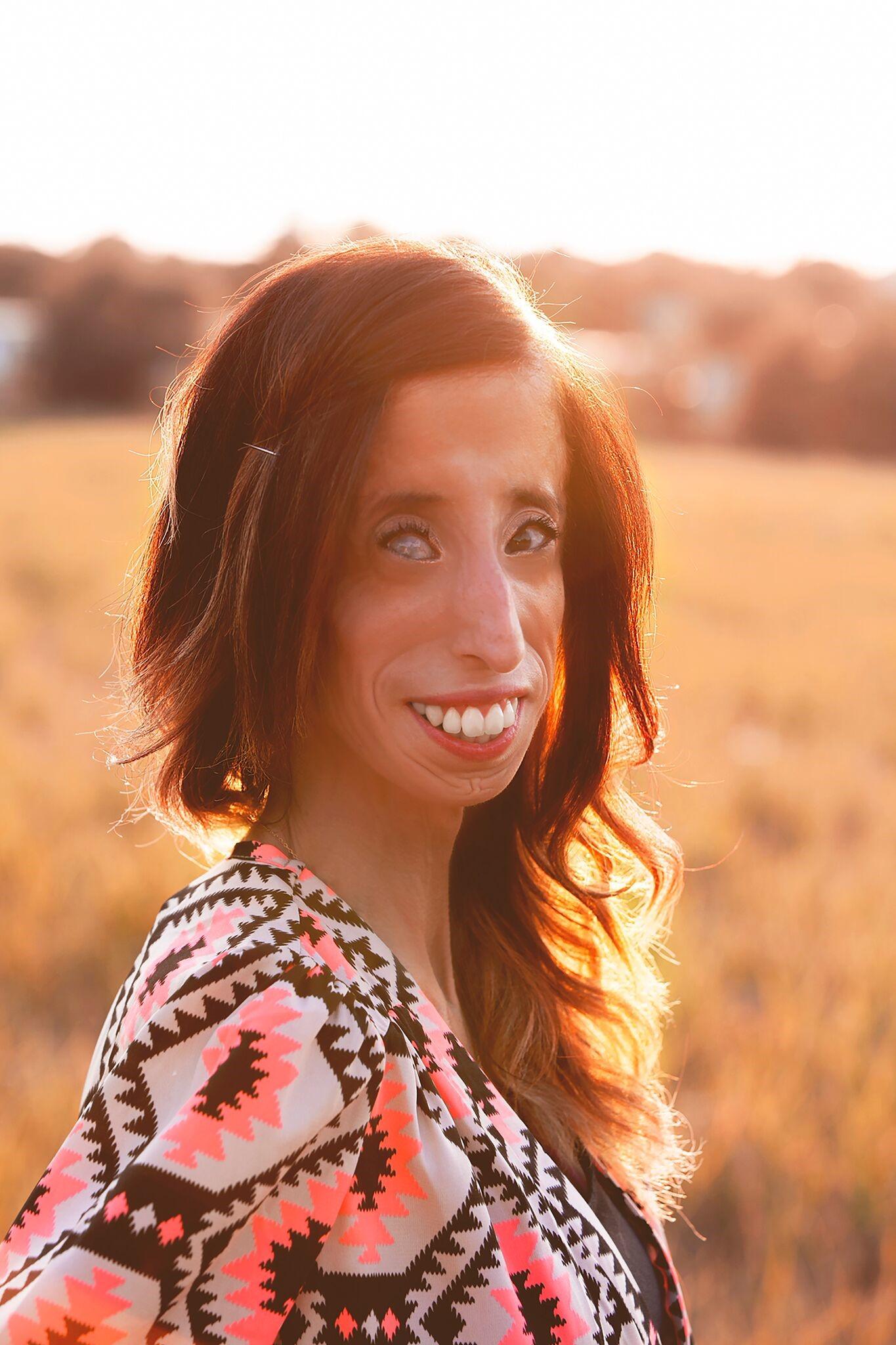 Once called ‘World’s Ugliest Woman,’ Lizzie Velasquez fights bullying with her new doc