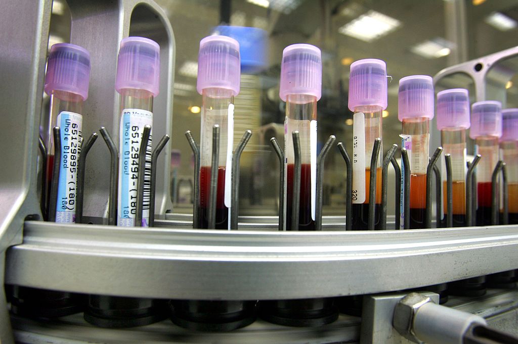 Israeli Laboratory Leads Western World In Blood Testing