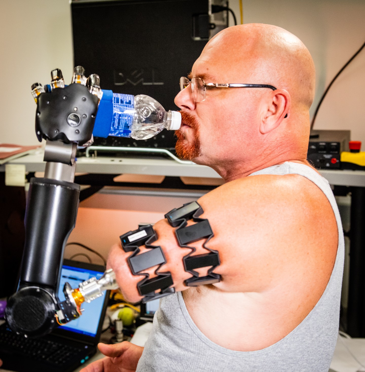 Prosthetic user with myoelectric armbands
