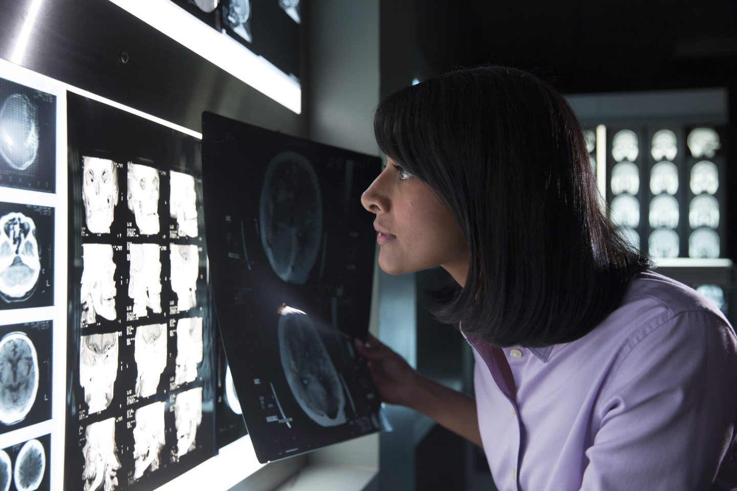 On August 6, 2015 IBM announced that Watson will to gain the ability to "see" by bringing together Watson’s advanced image analytics and cognitive capabilities with data and images obtained from Merge Healthcare Incorporated’s medical imaging management platform. The vision is that these organizations could use the Watson Health Cloud to surface new insights from a consolidated, patient-centric view of current and historical images, electronic health records, data from wearable devices and other related medical data, in a HIPAA-enabled environment. (Photo Credit: IBM)