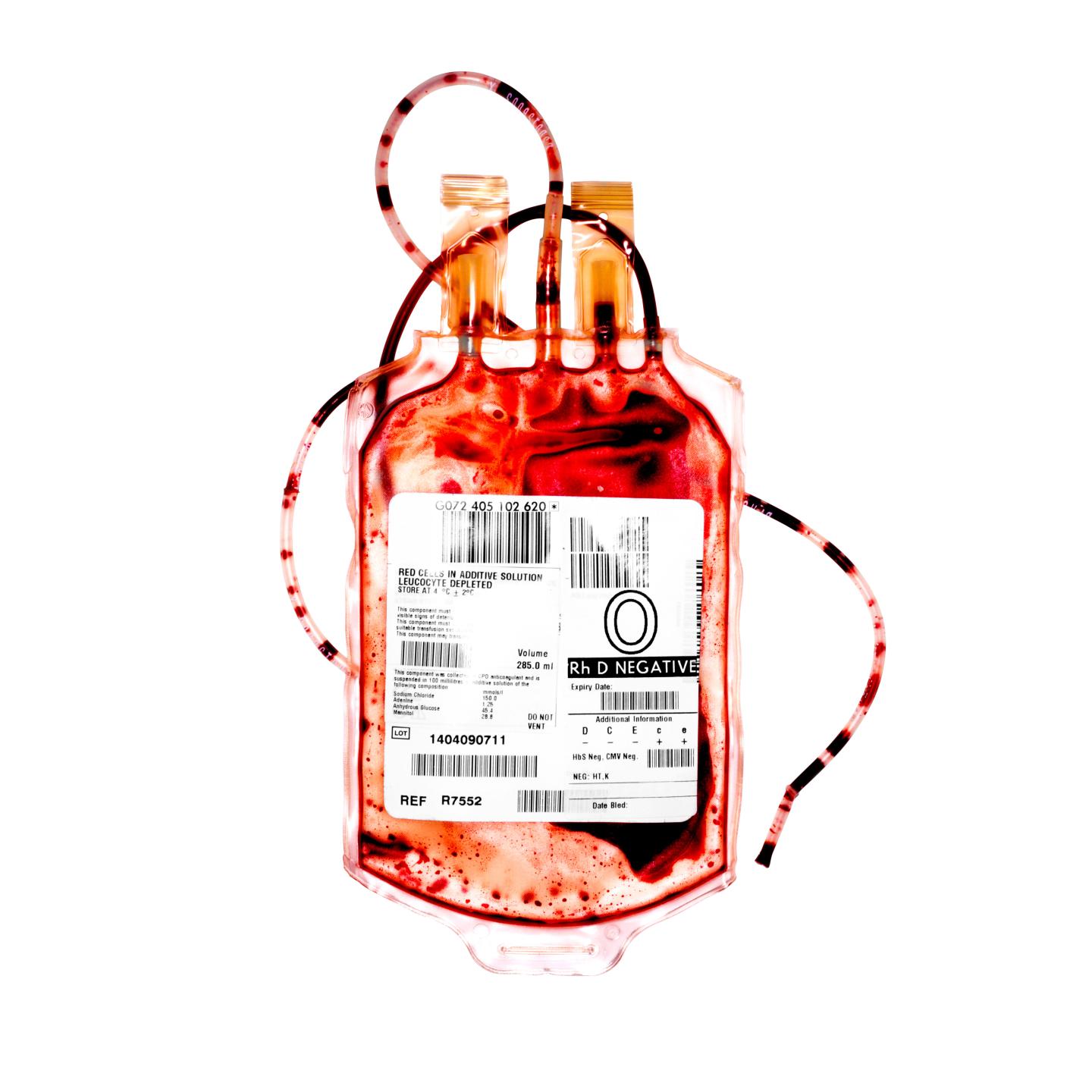 Empty blood bag