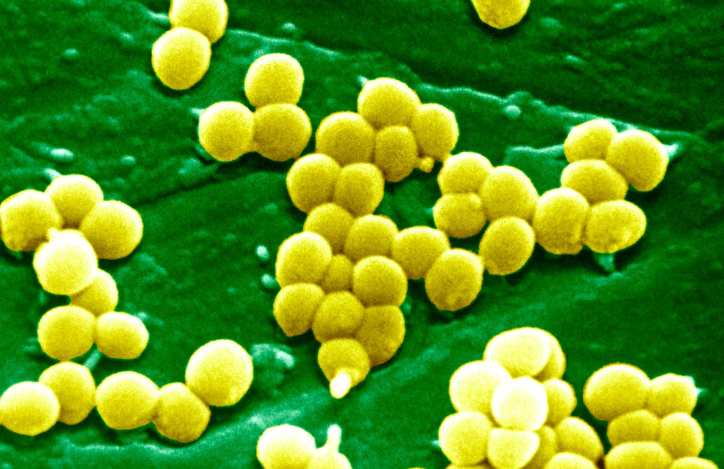 Staphylococcus Aureus Sem