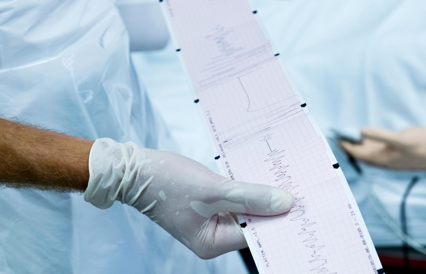 Elektrocardiogram