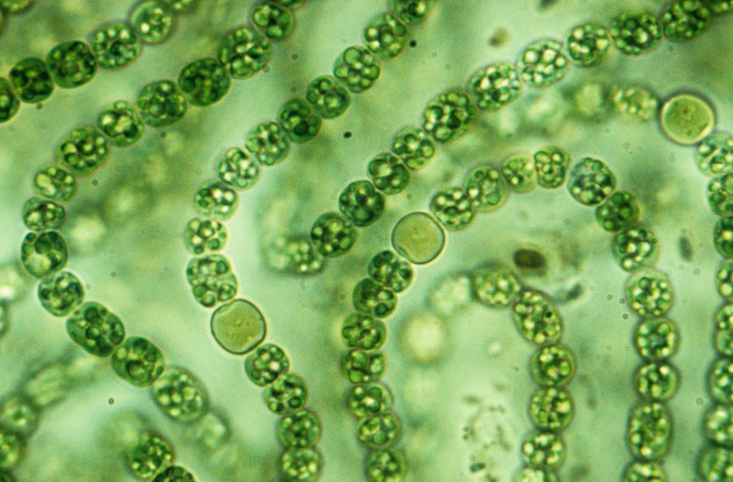 Nostoc filamentous Cyanobacteria with heterocysts. LM X1000