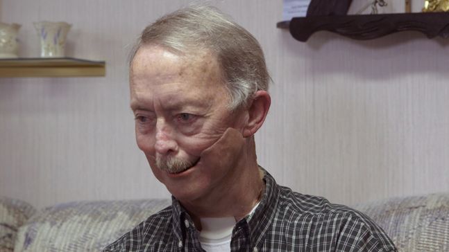 3D Modeled Jaw Prosthesis