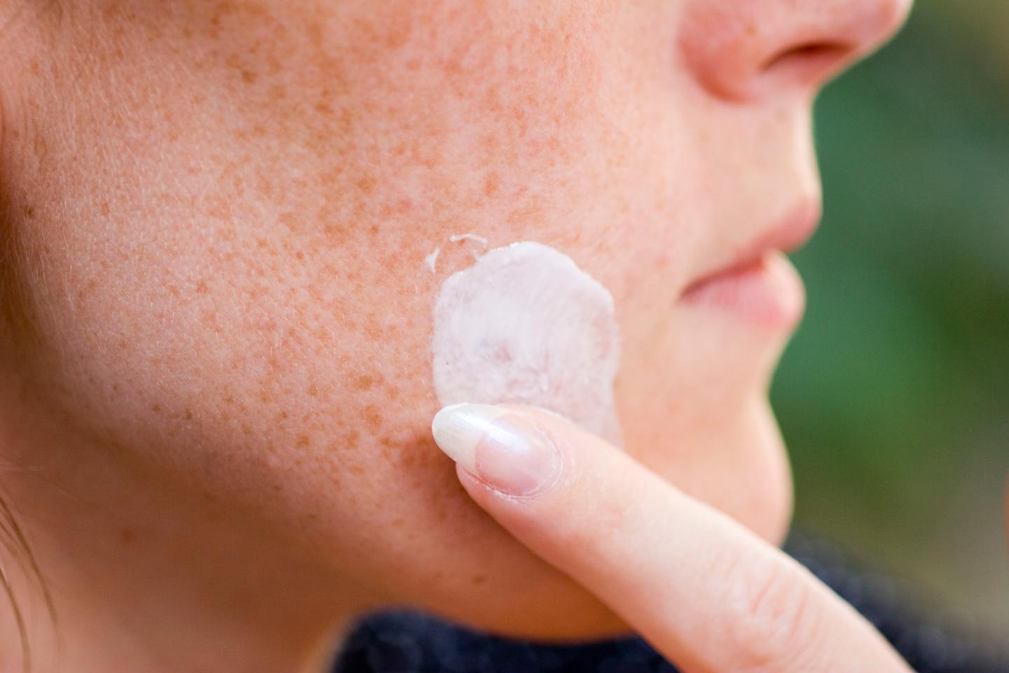 Herpes Treatment