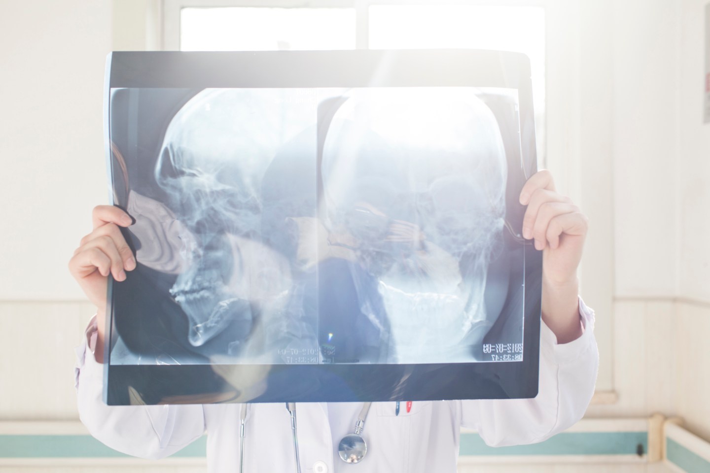 surgeon looking at X-ray film in hospital