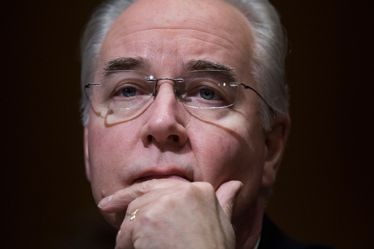 Price Hearing