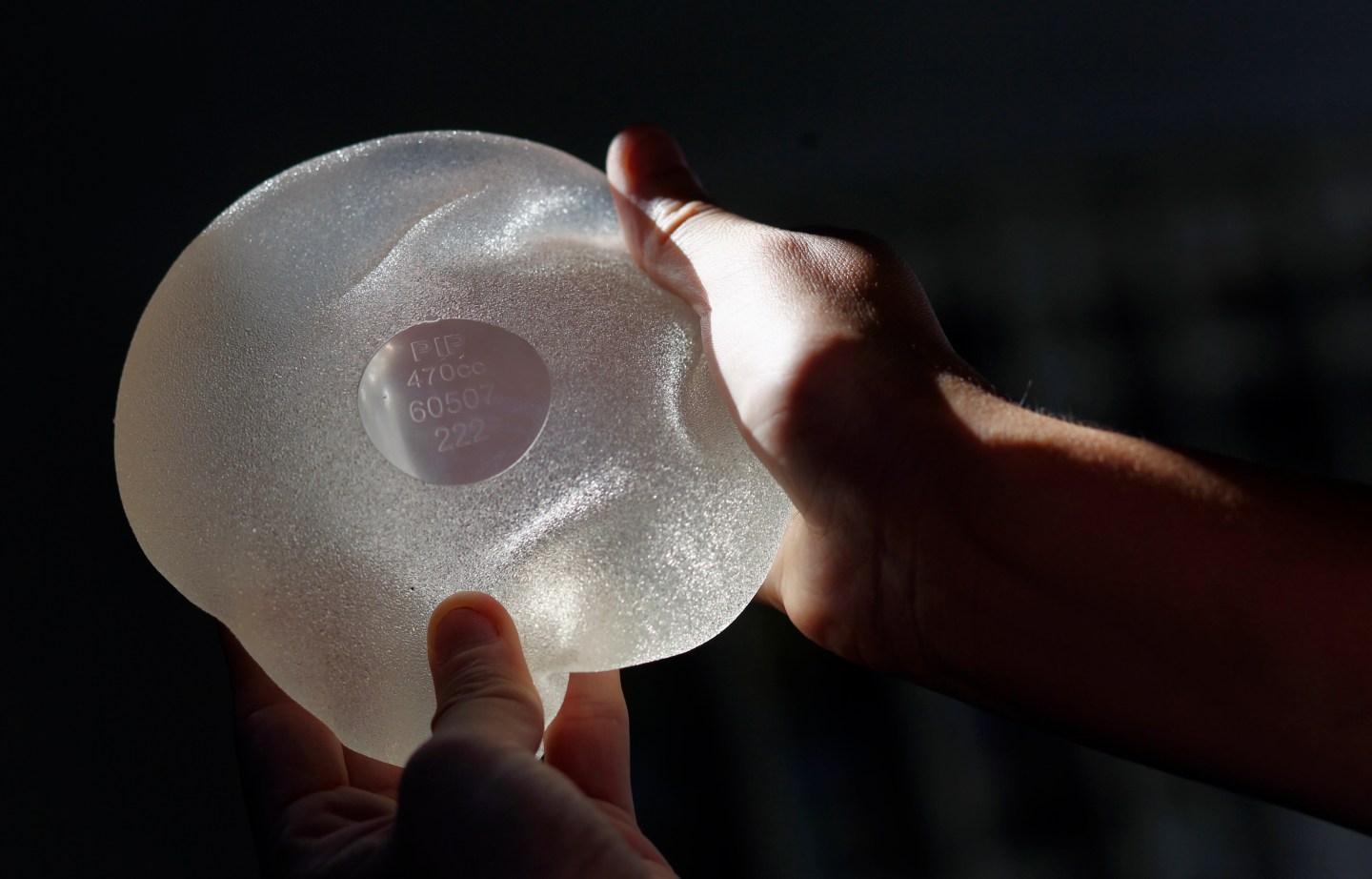 Rolon holds one of the silicone gel breast implants manufactured by PIP that she had to have removed, during an interview with Reuters in Buenos Aires