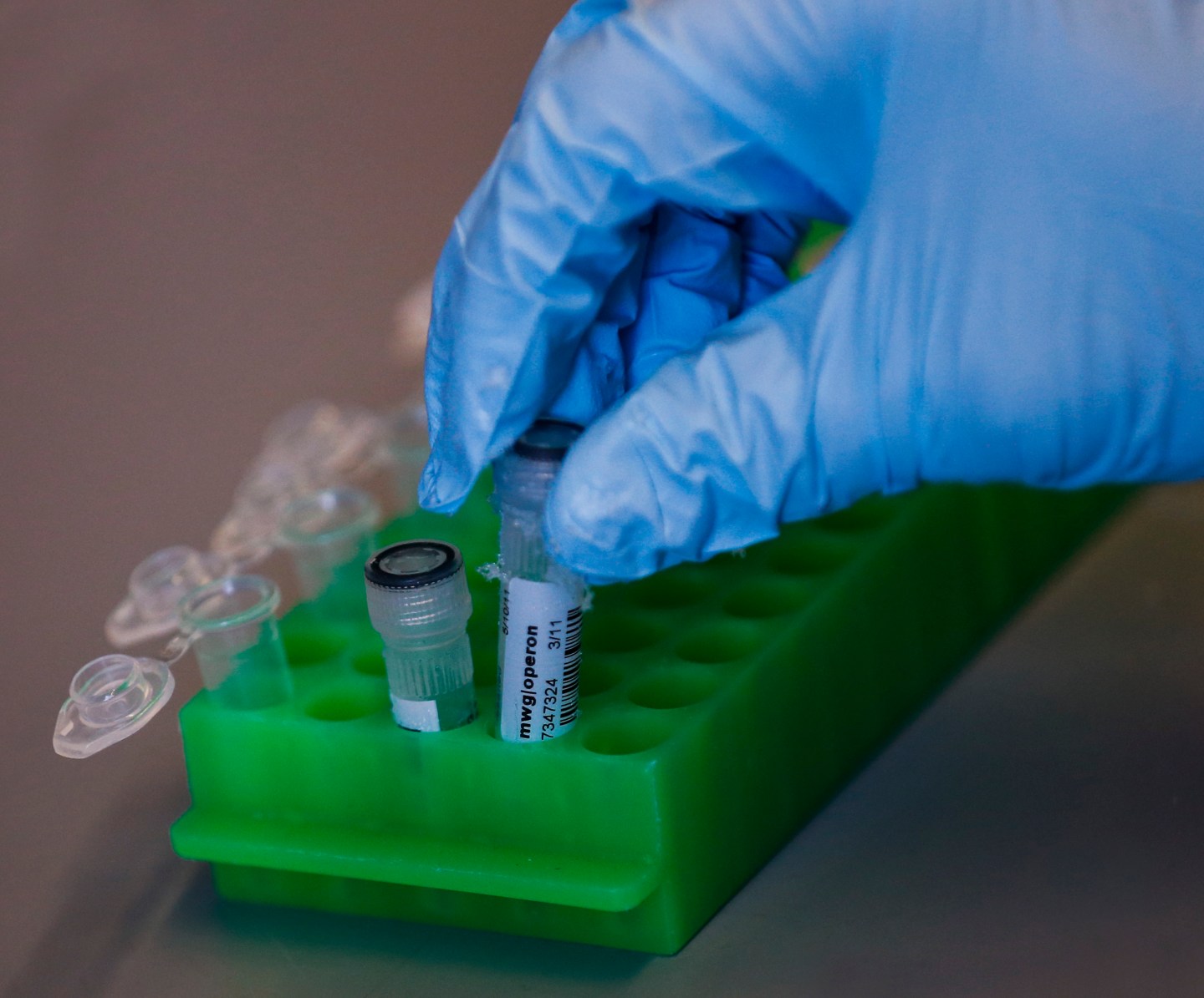 Researchers bring gene editing to patients with deadly diseases