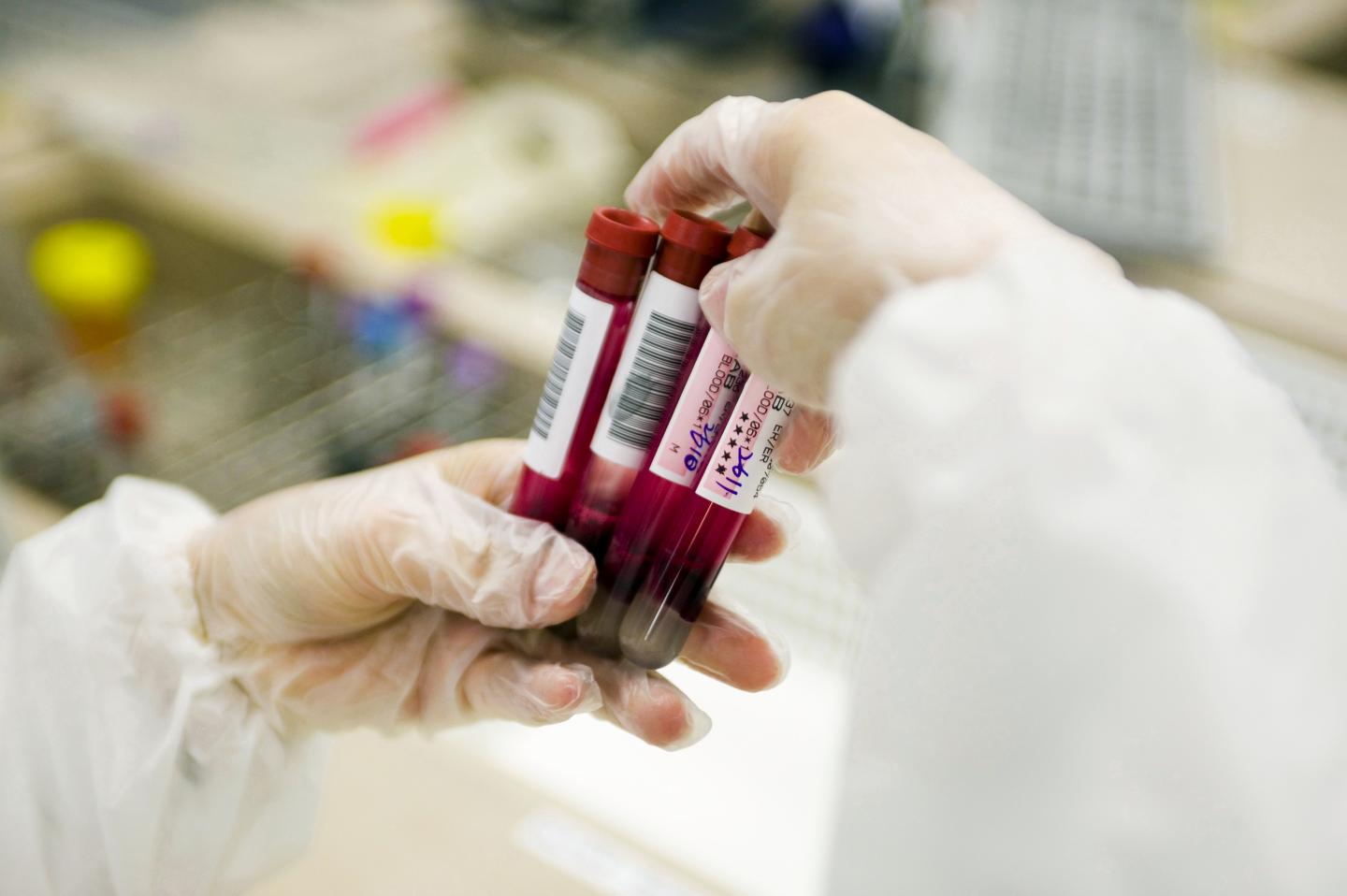 Laboratory technician holding test tubes containing blood samples