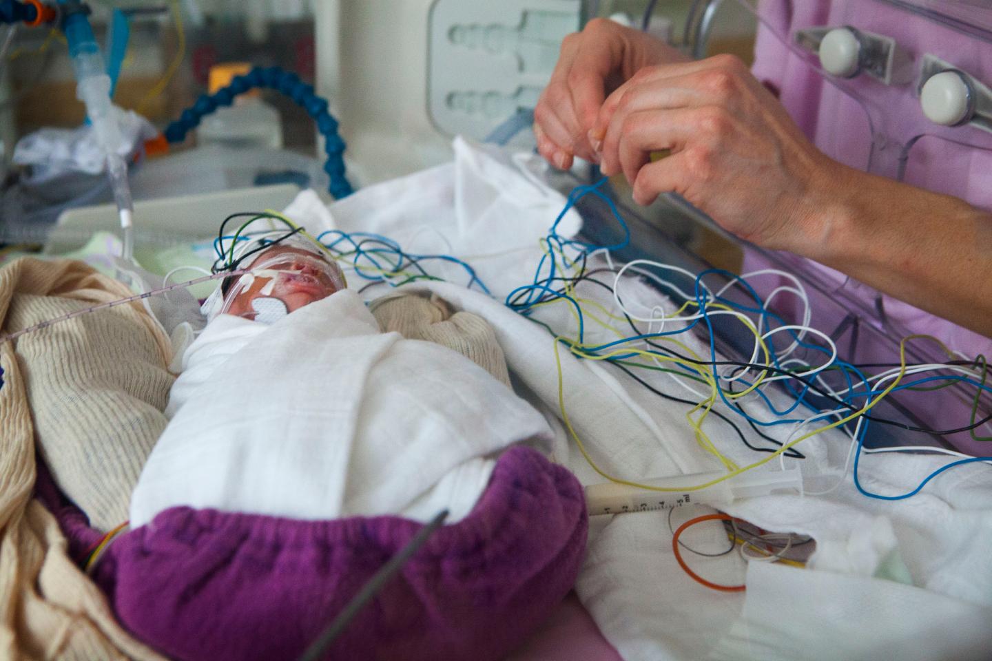 Neonatology