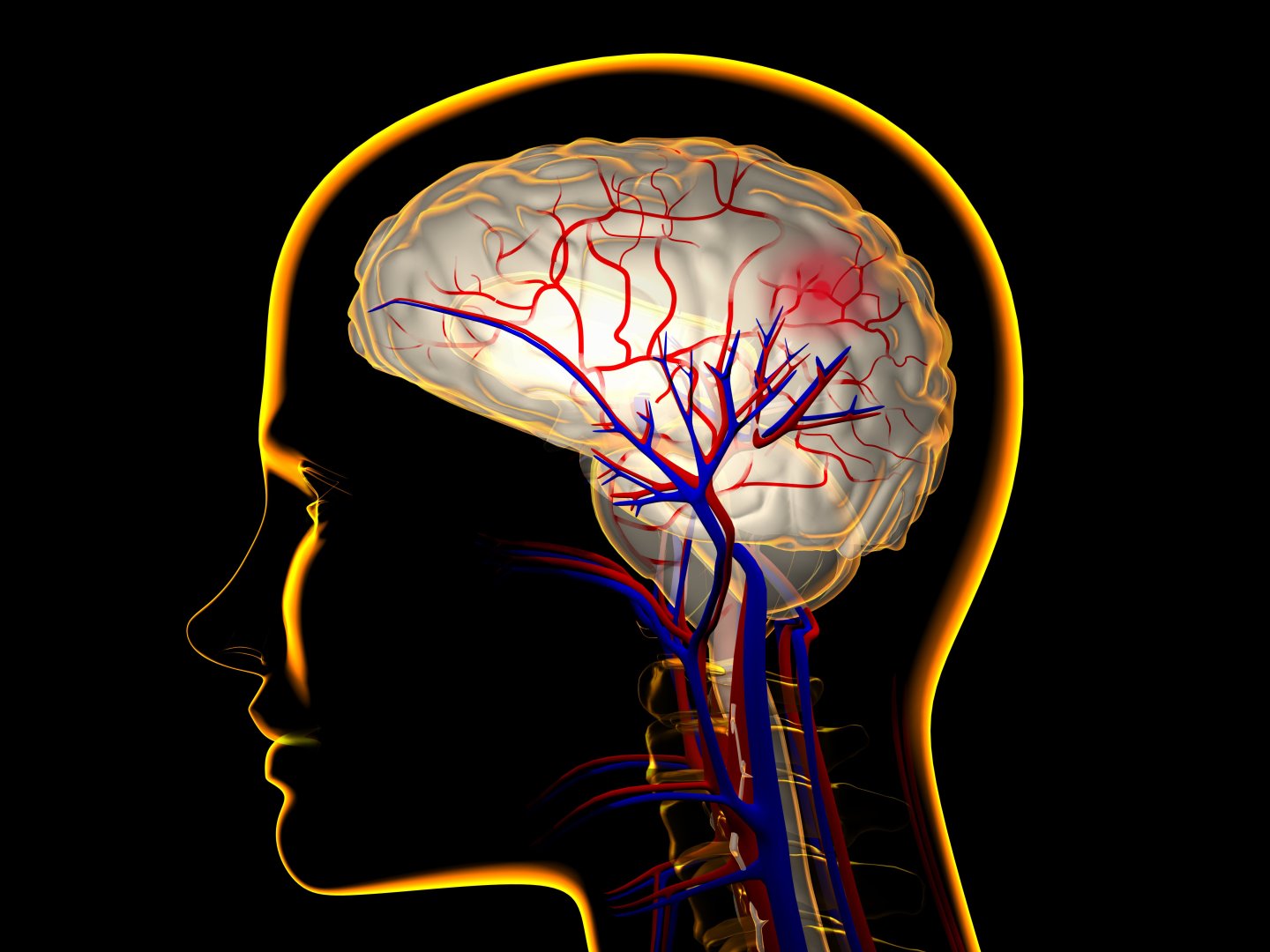 Cerebrovascular Neurol Disease