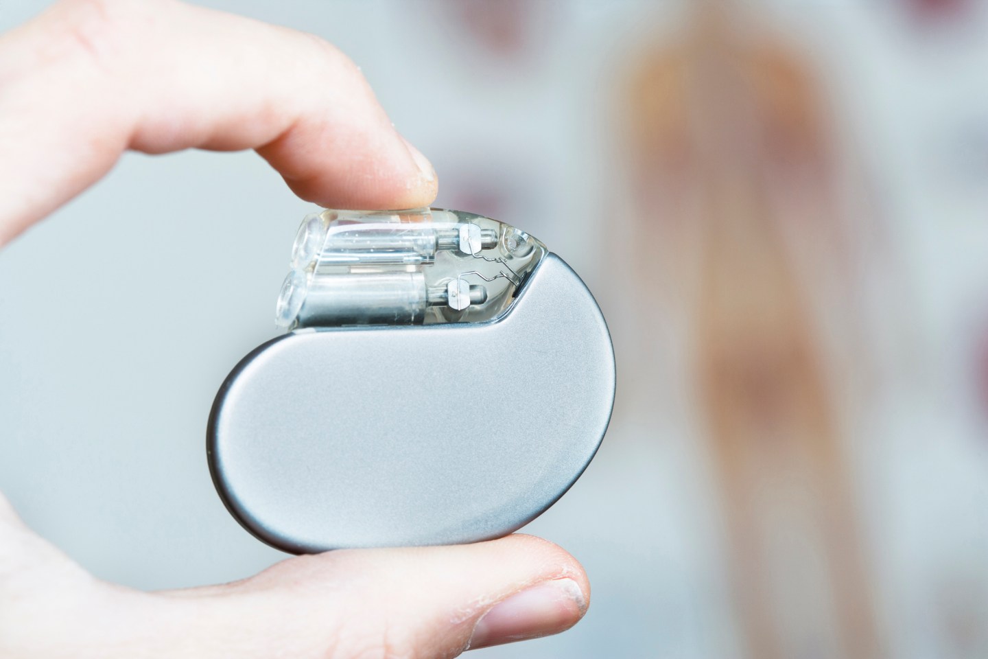 Cardiac pacemaker