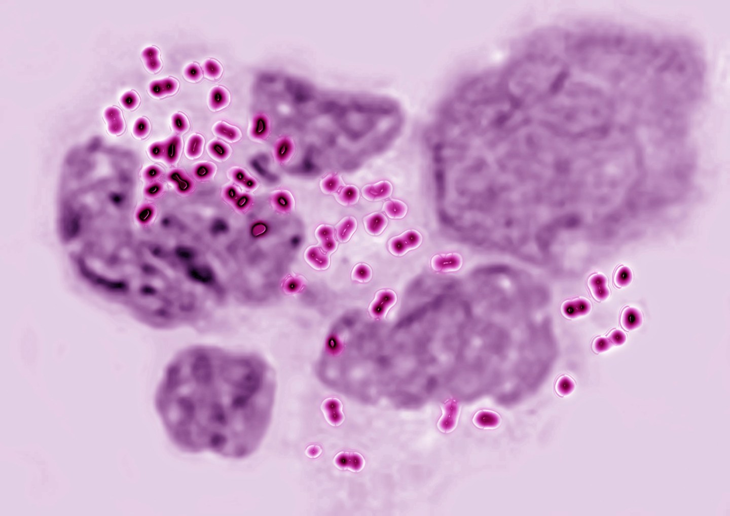 Neisseria Gonorrhoeae
