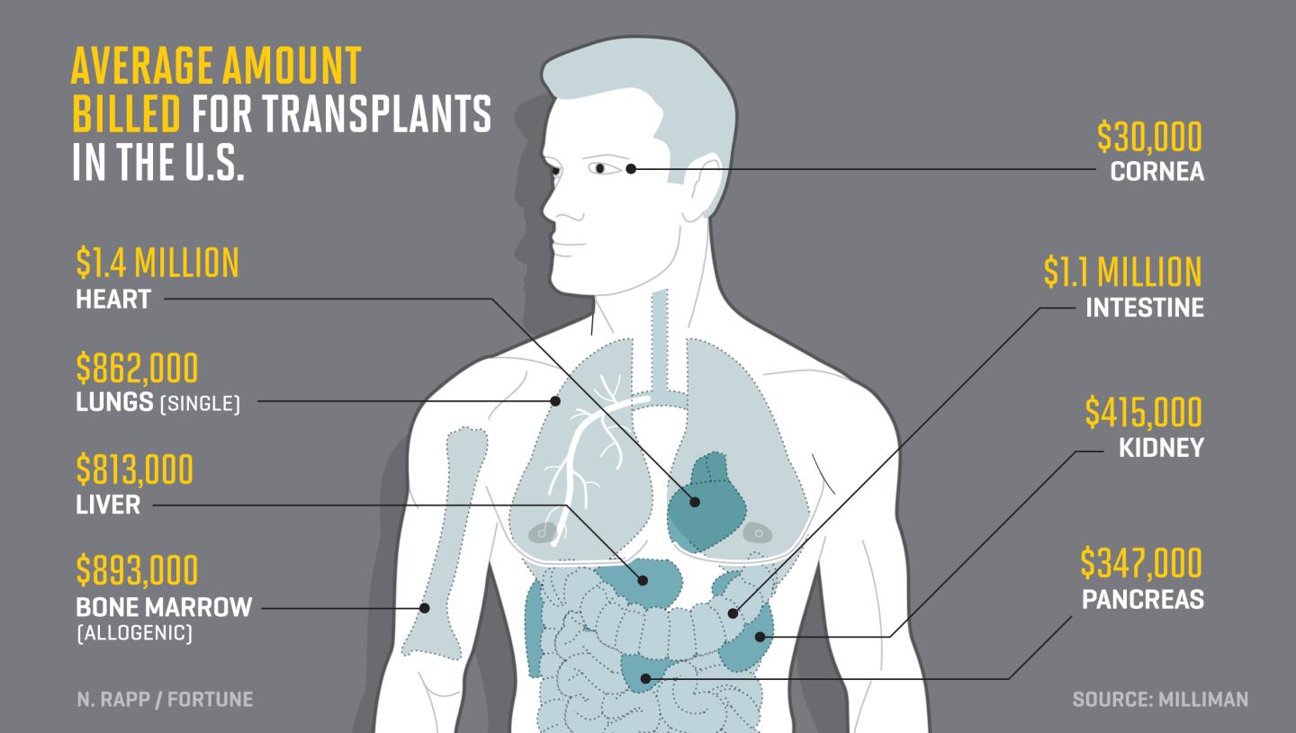 Here’s What Every Organ in the Body Would Cost to Transplant