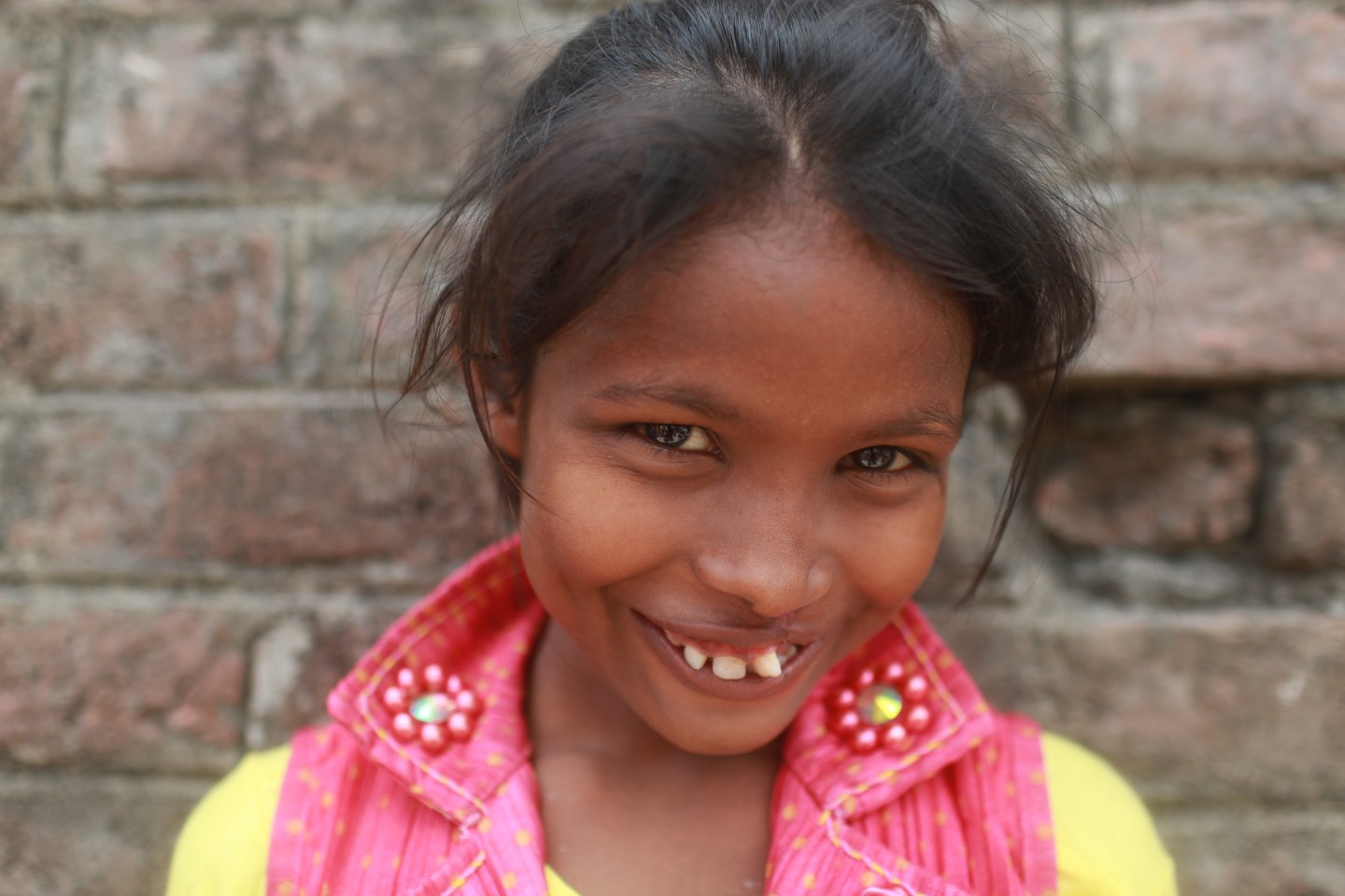 One VR production by nonprofit Smile Train follows the journey of young Nisha (pictured) as she leaves her remote village for surgery and the exuberant joy she experiences post-operation upon her return.