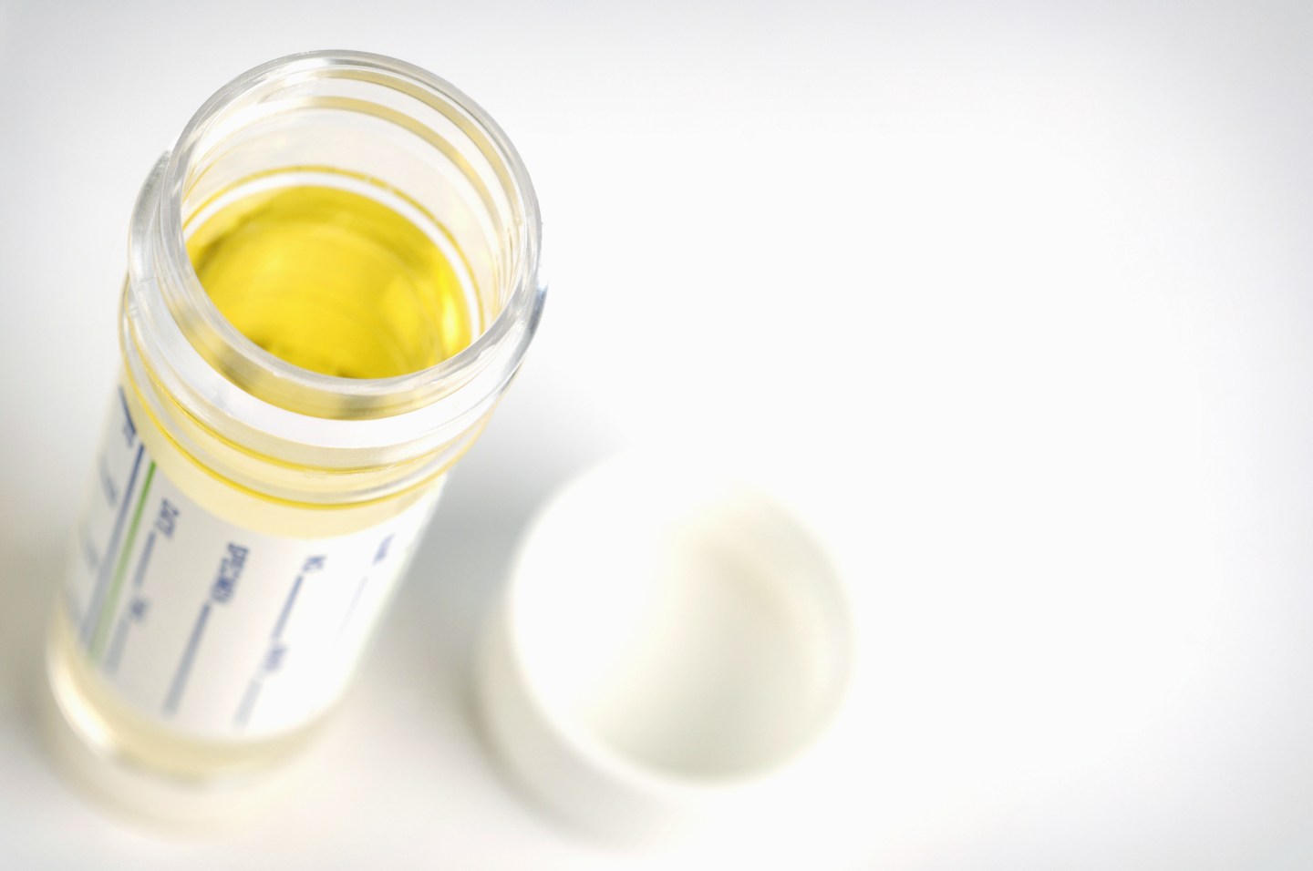 Studio shot of urine sample