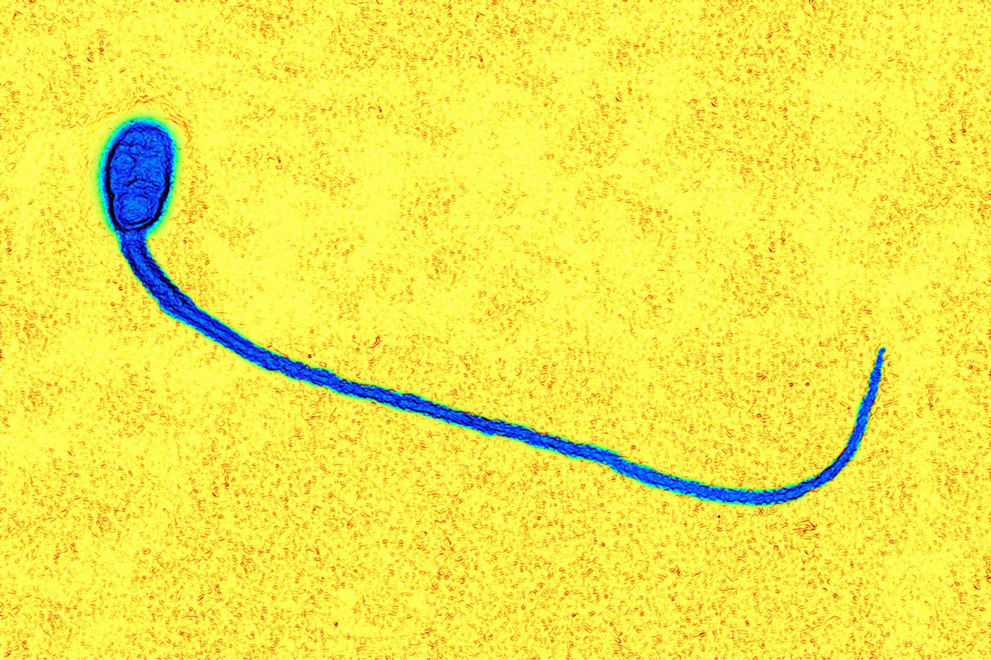 digital-light-sperm-microscope