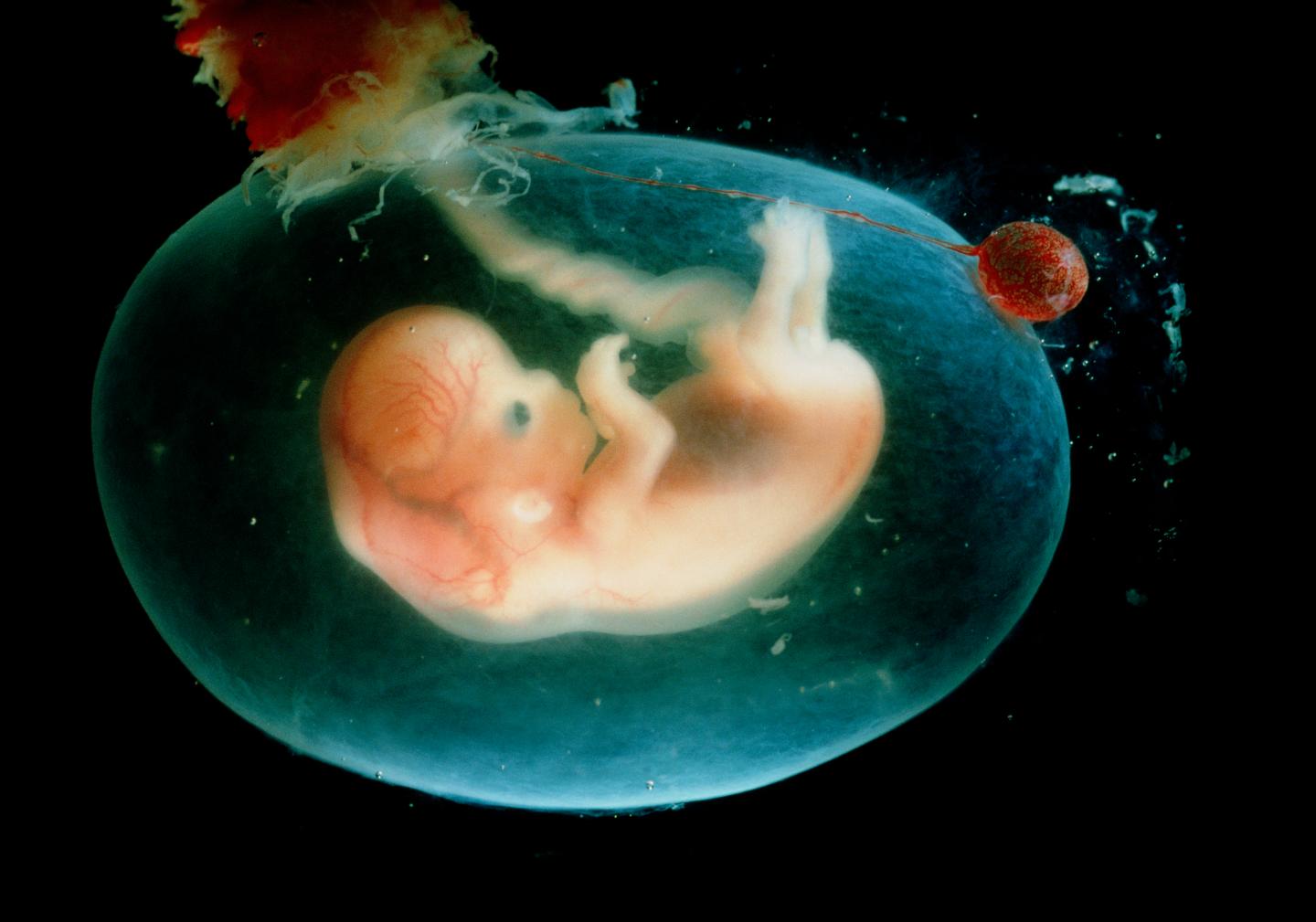 Frozen Embryos Aren’t Always Necessary for IVF, New Studies Show