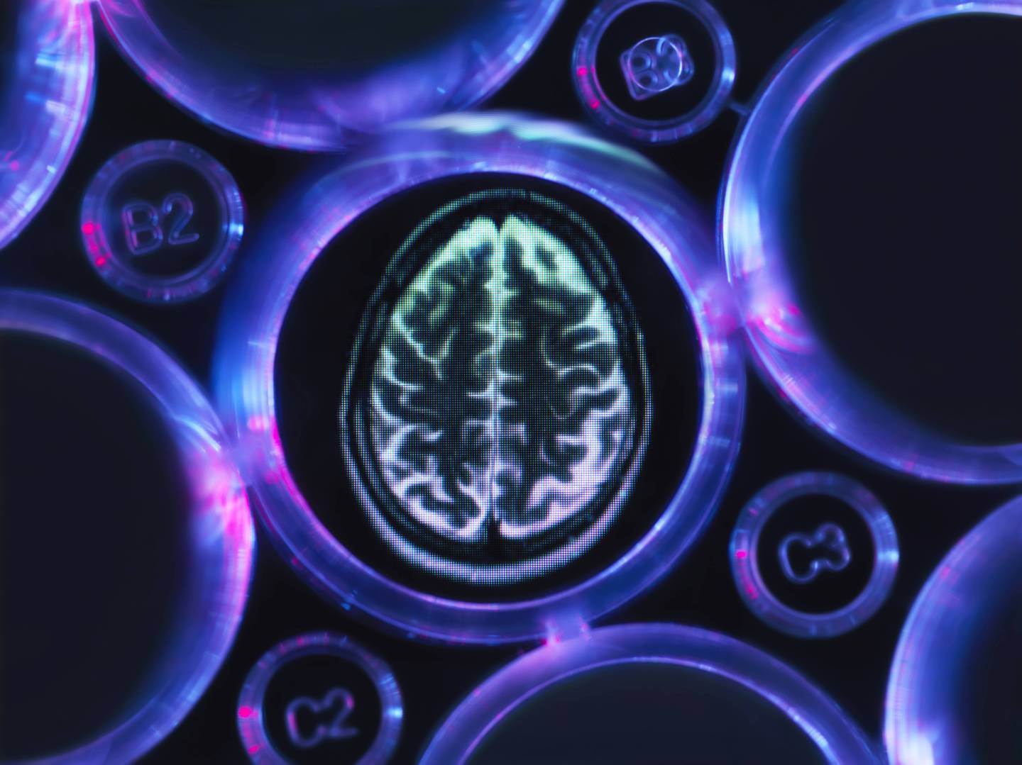 Alzheimers-dementia-brain-research