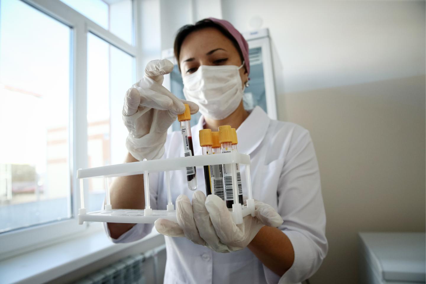 Scientists holds blood samples