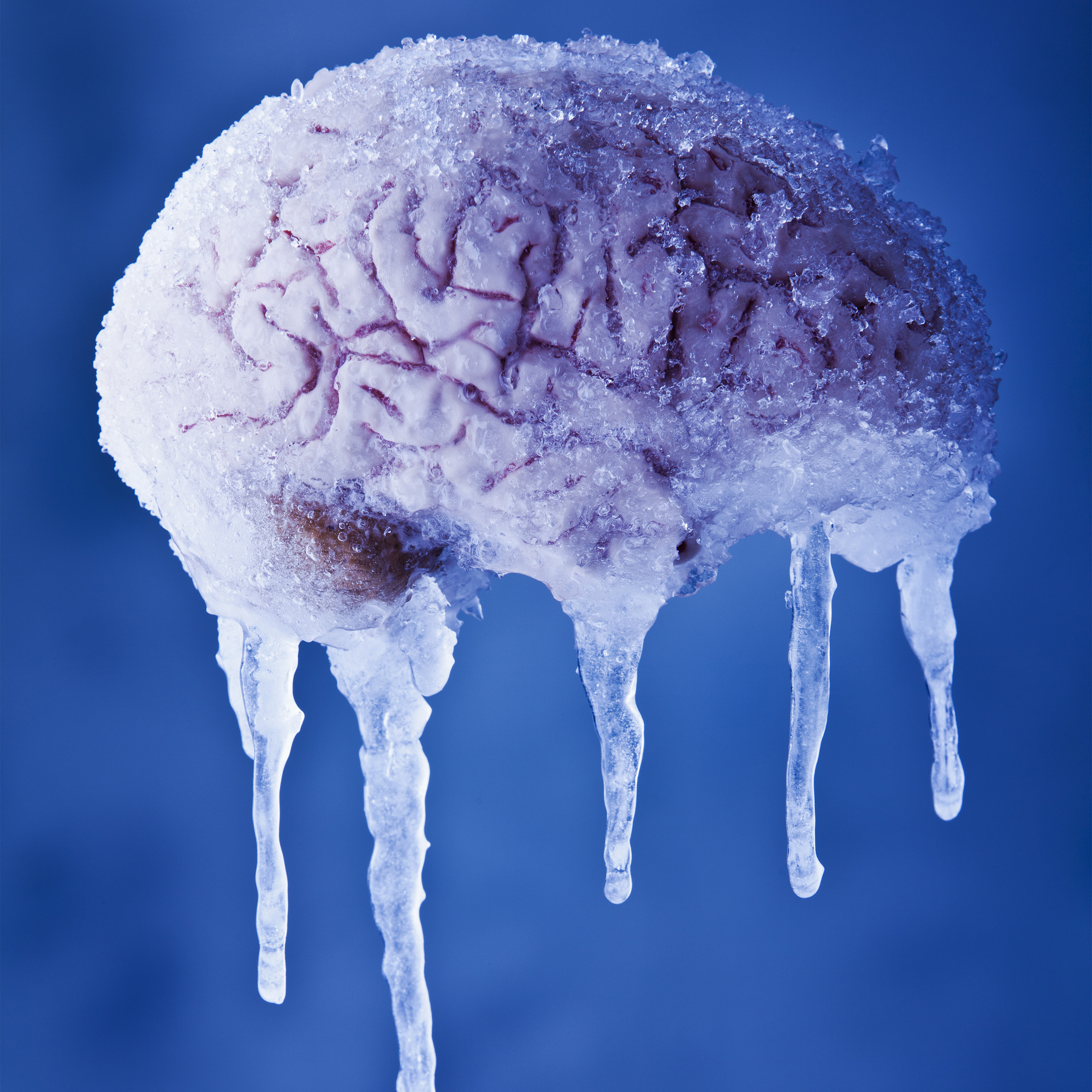 ミュージック BRAIN FREEZE ミュージック BRAIN FREEZE ミュージック BRAIN FREEZE Amazon.com