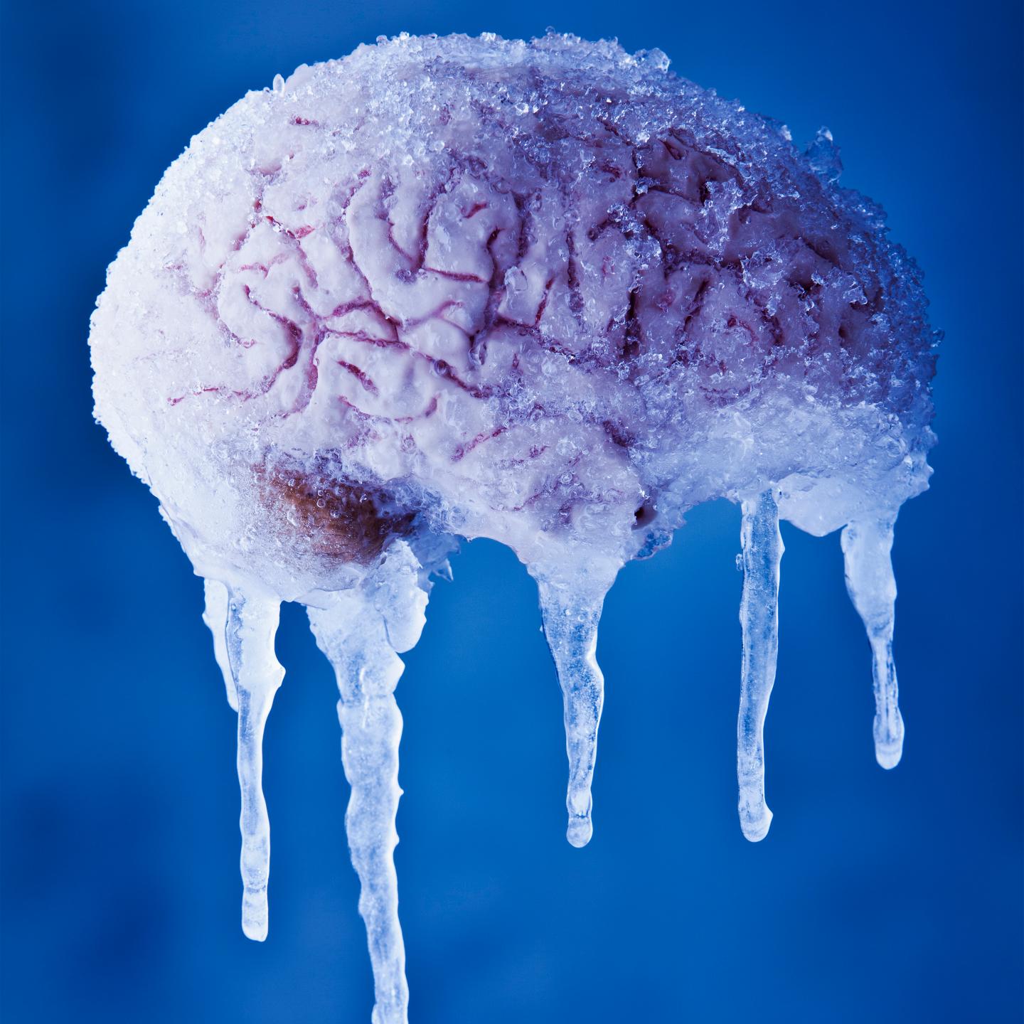 netcome-mit-contract-brain-preserve