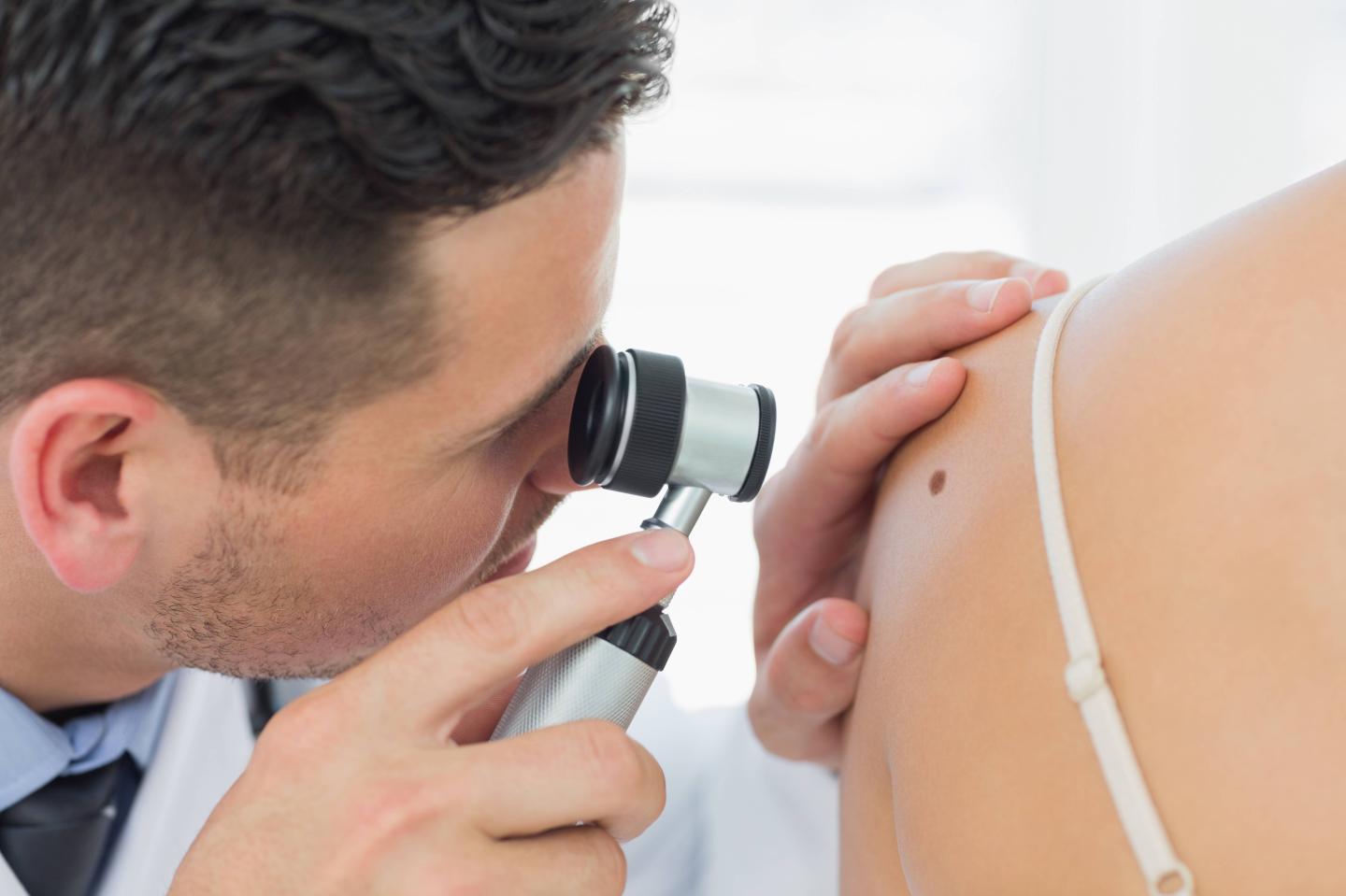 Melanoma blood test