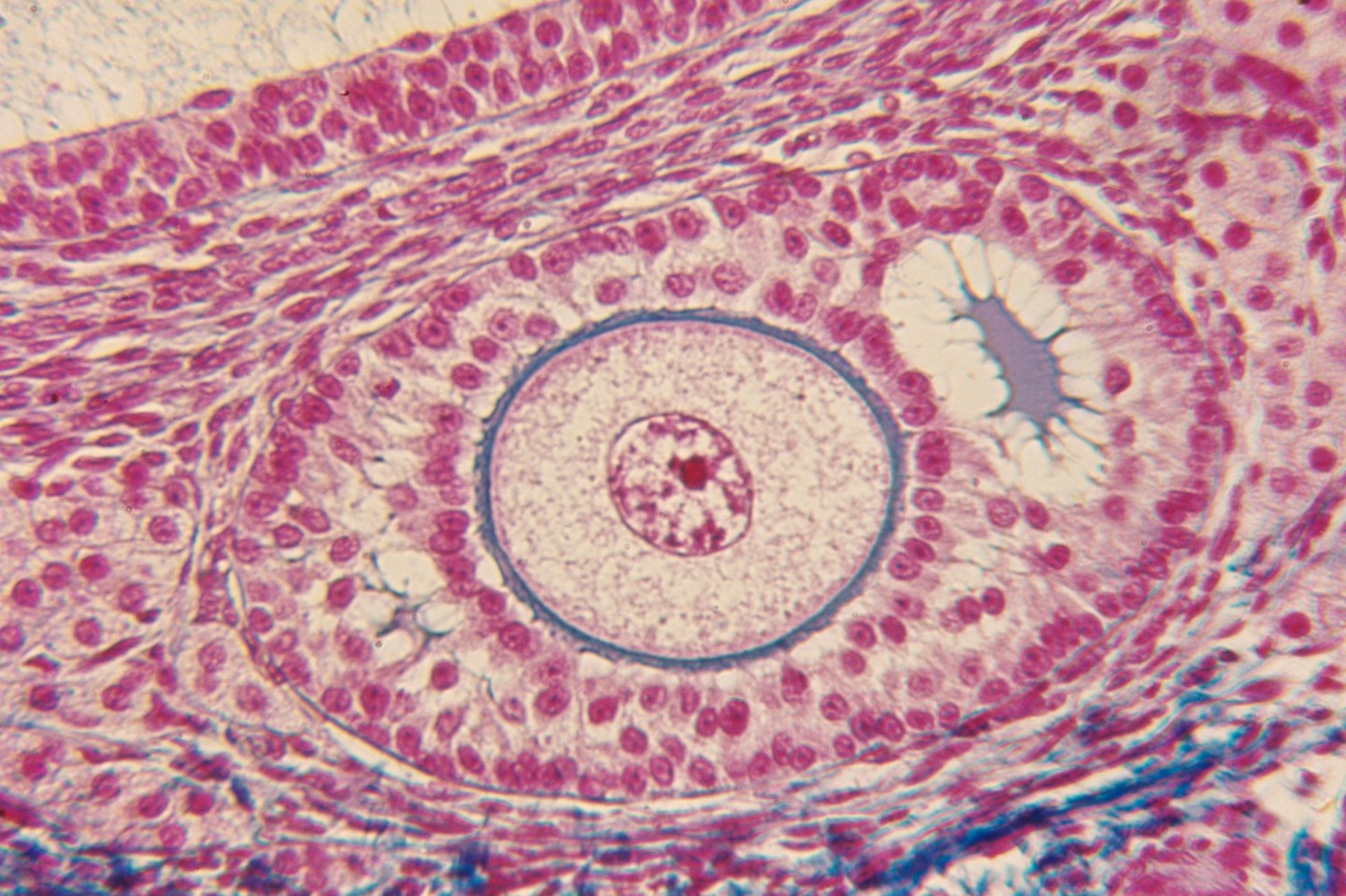 Section of human ovarian follicle