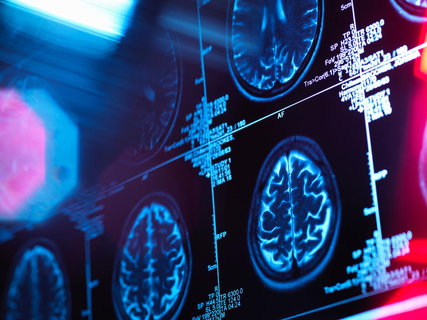 Facebook NYU AI MRI