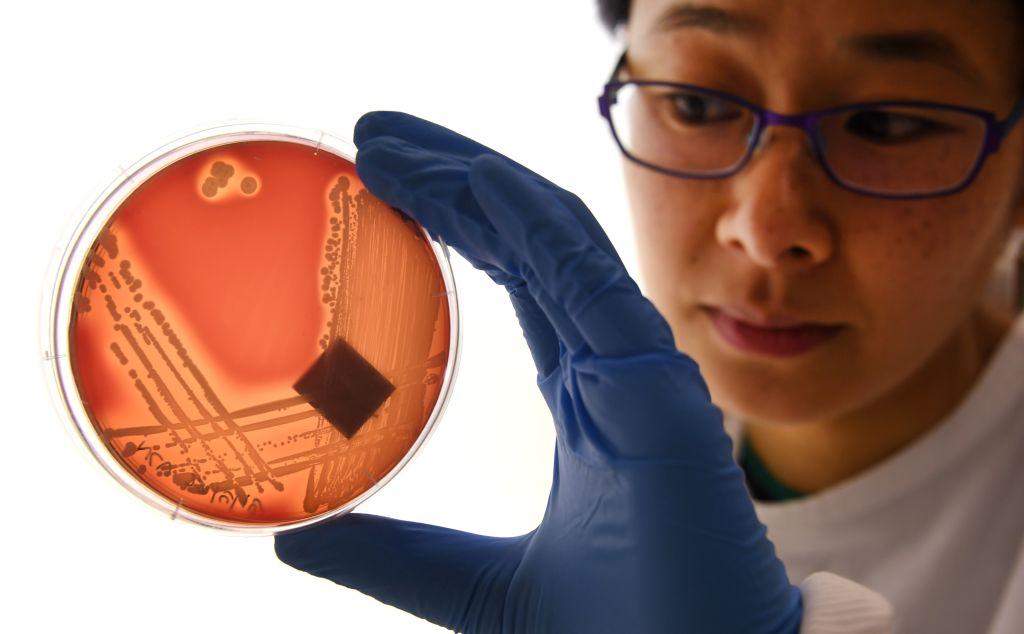 AUSTRALIA-HEALTH-HOSPITAL-DISEASE-SUPERBUG