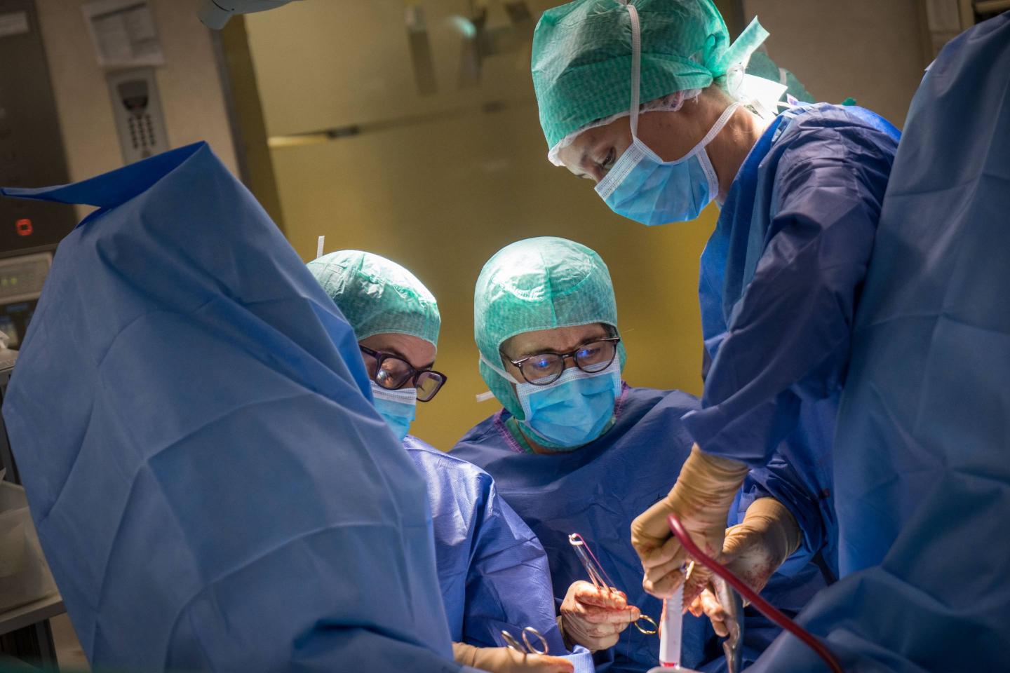 Hysterectomy