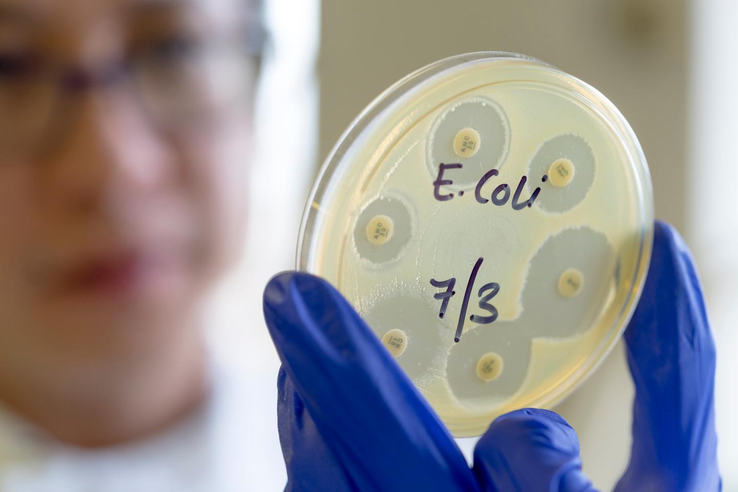 Microbiologist holding an antibiotic sensitivity plate of an E. coli bacteria