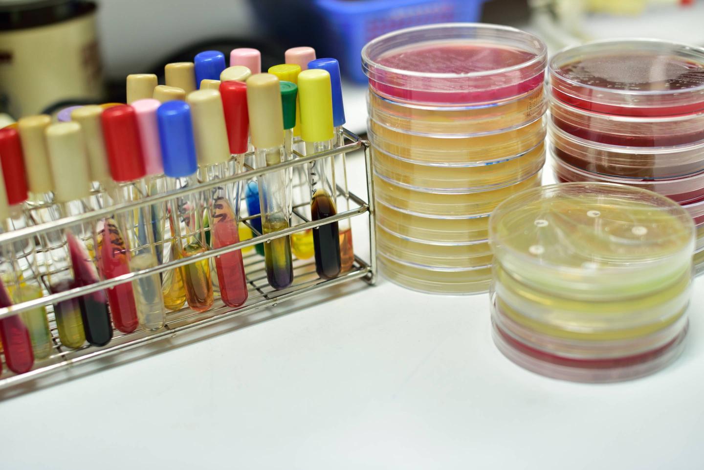 Bacteria culture