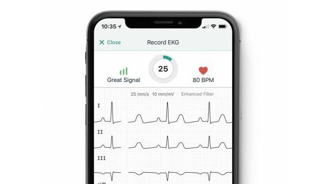 AliveCor's KardiaMobile smartphone app.