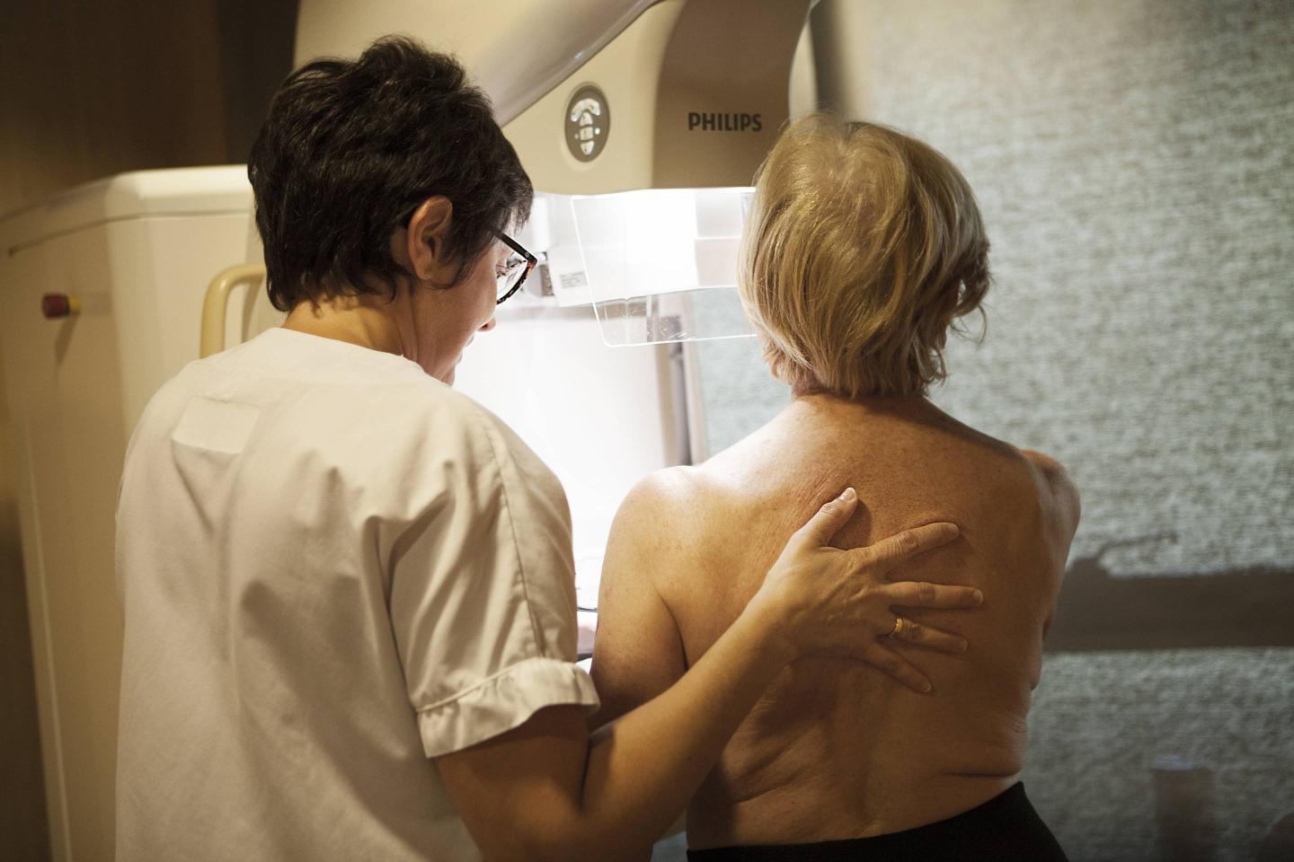 breast cancer screening