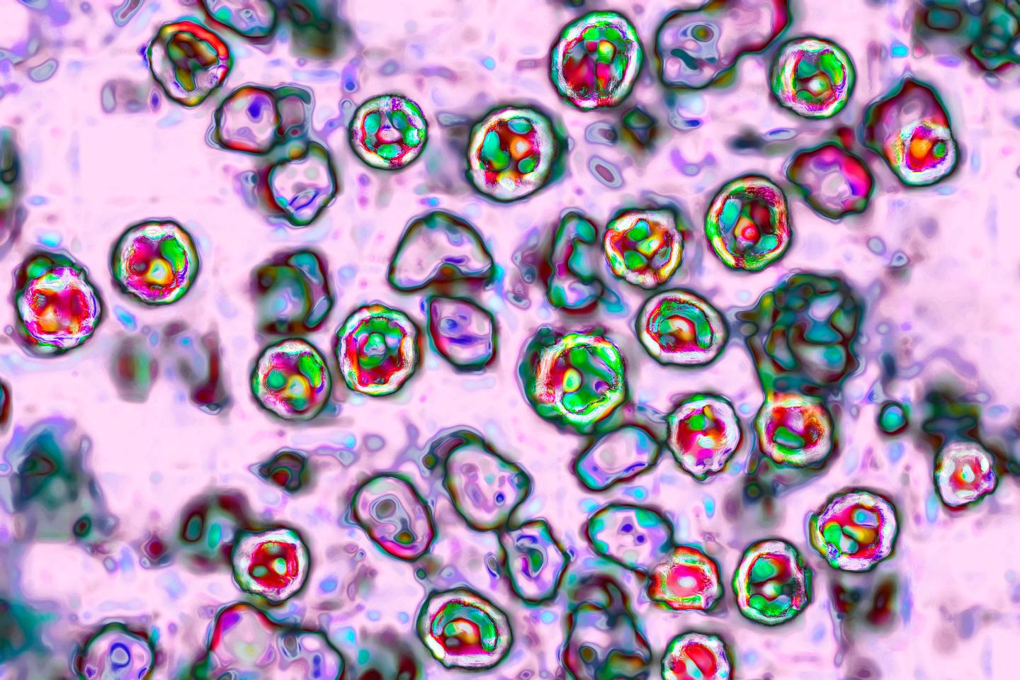 measles-virus