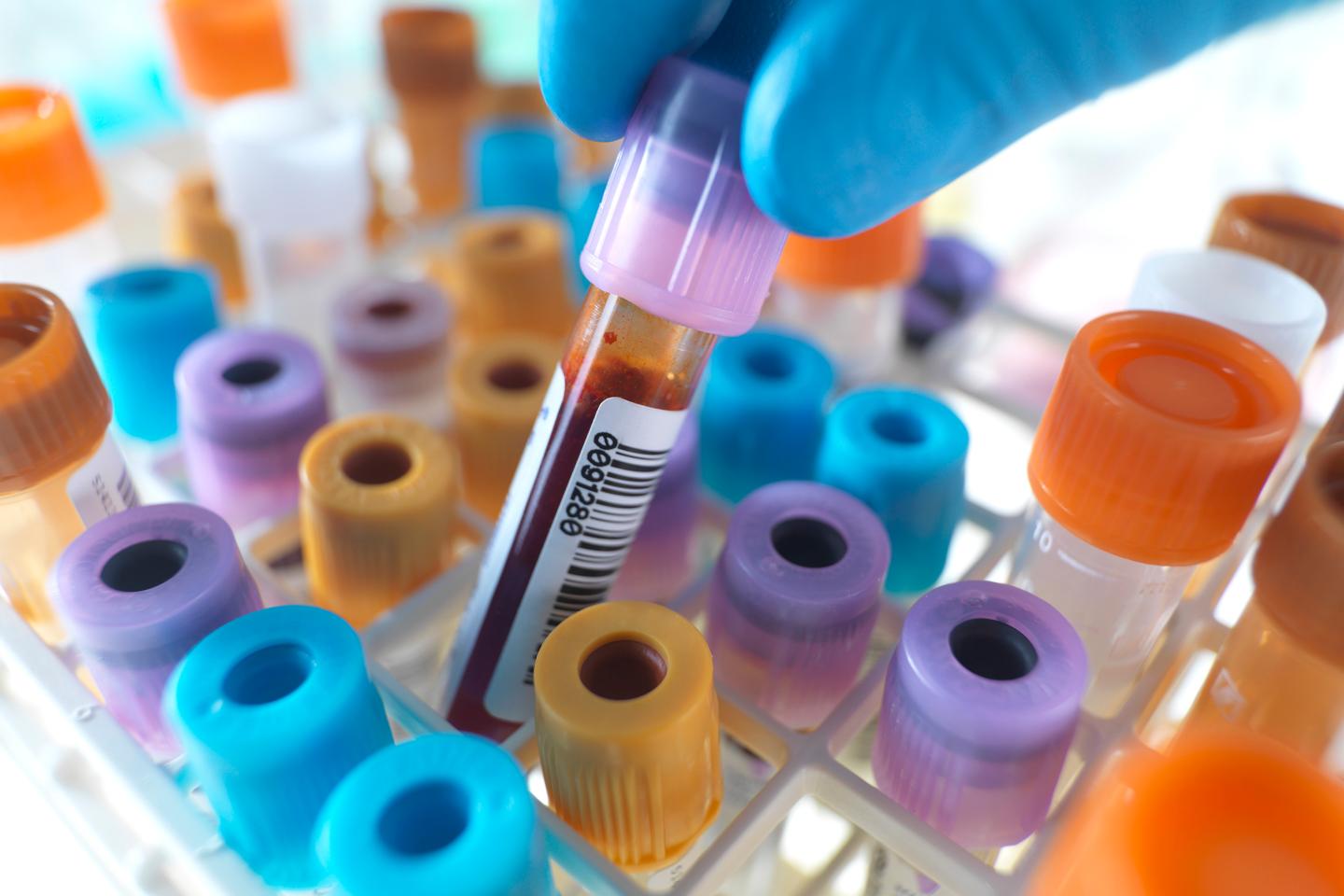 quest diagnostics data breach blood test
