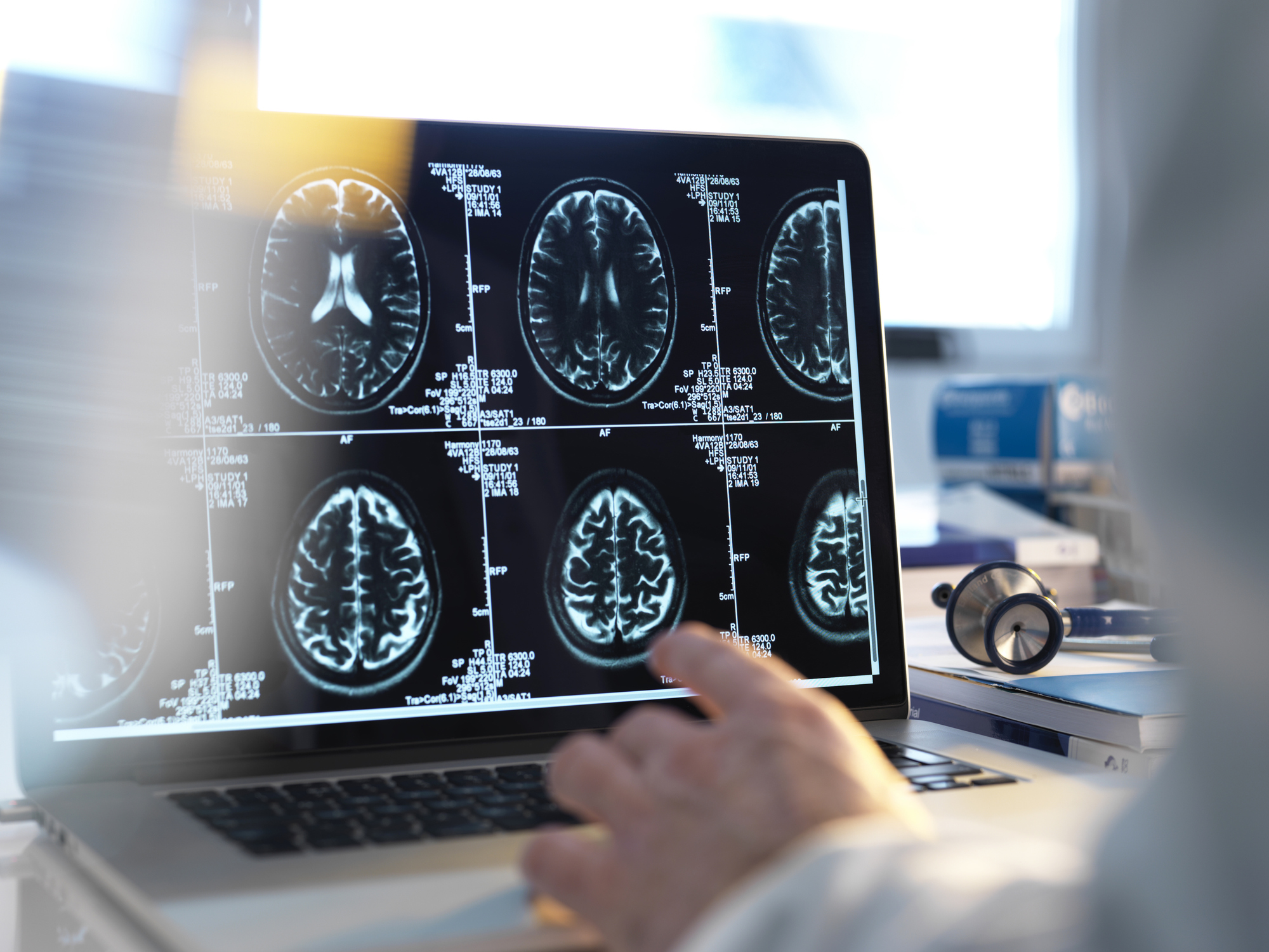 Doctors viewing brain scans made with magnetic resonance imaging.
