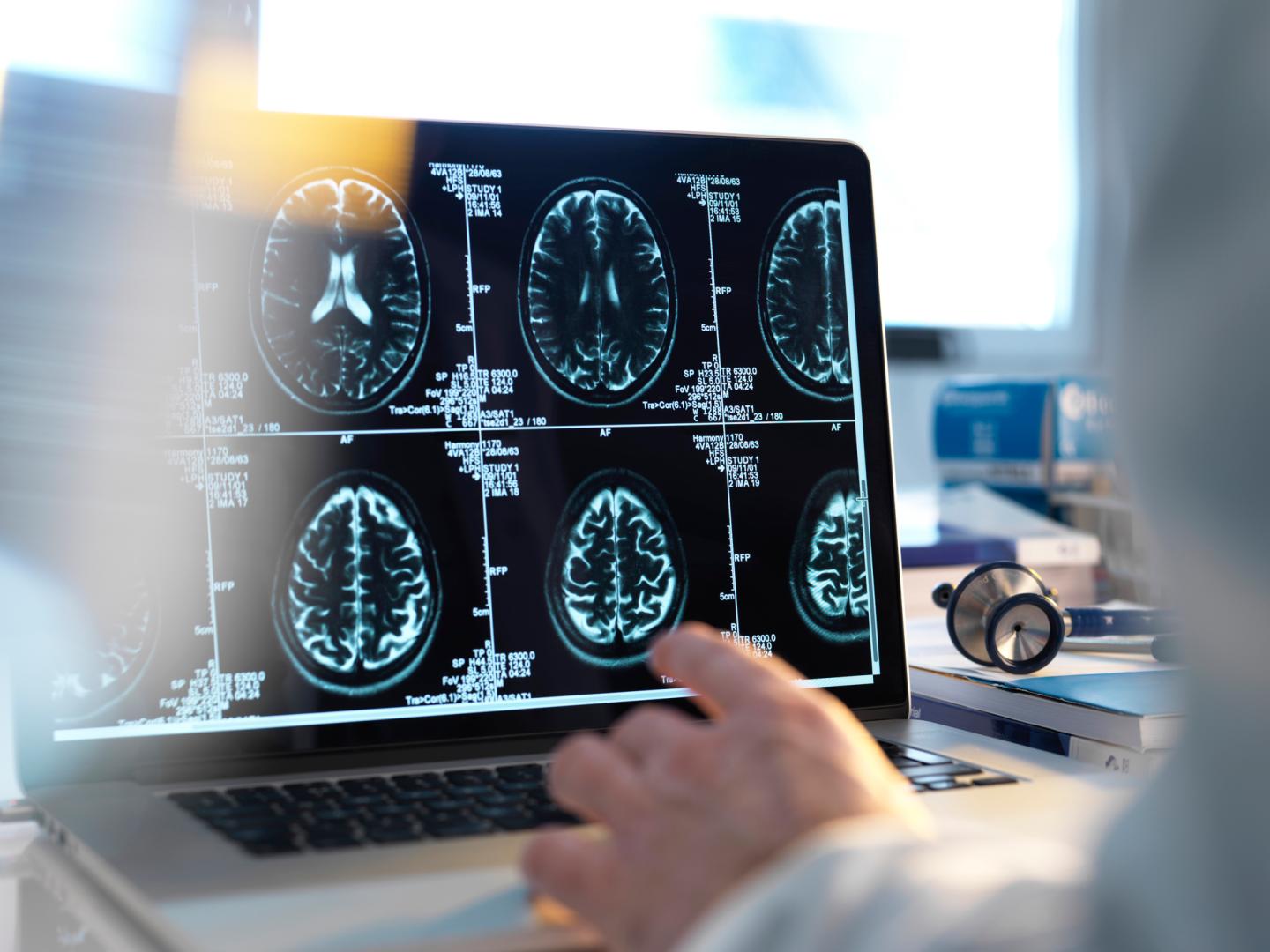 Doctors viewing brain scans made with magnetic resonance imaging.